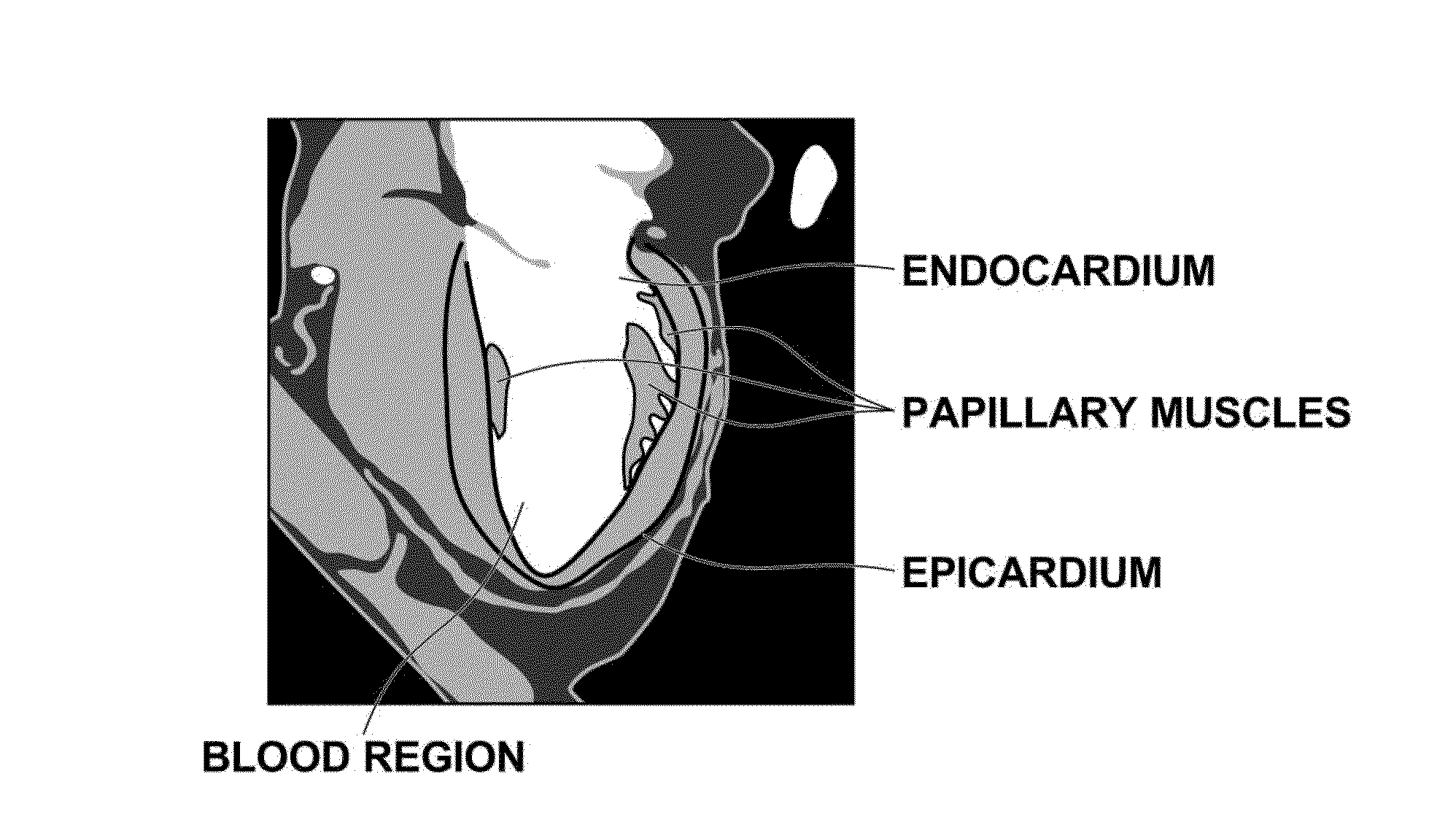 Medical image processing device, method and program