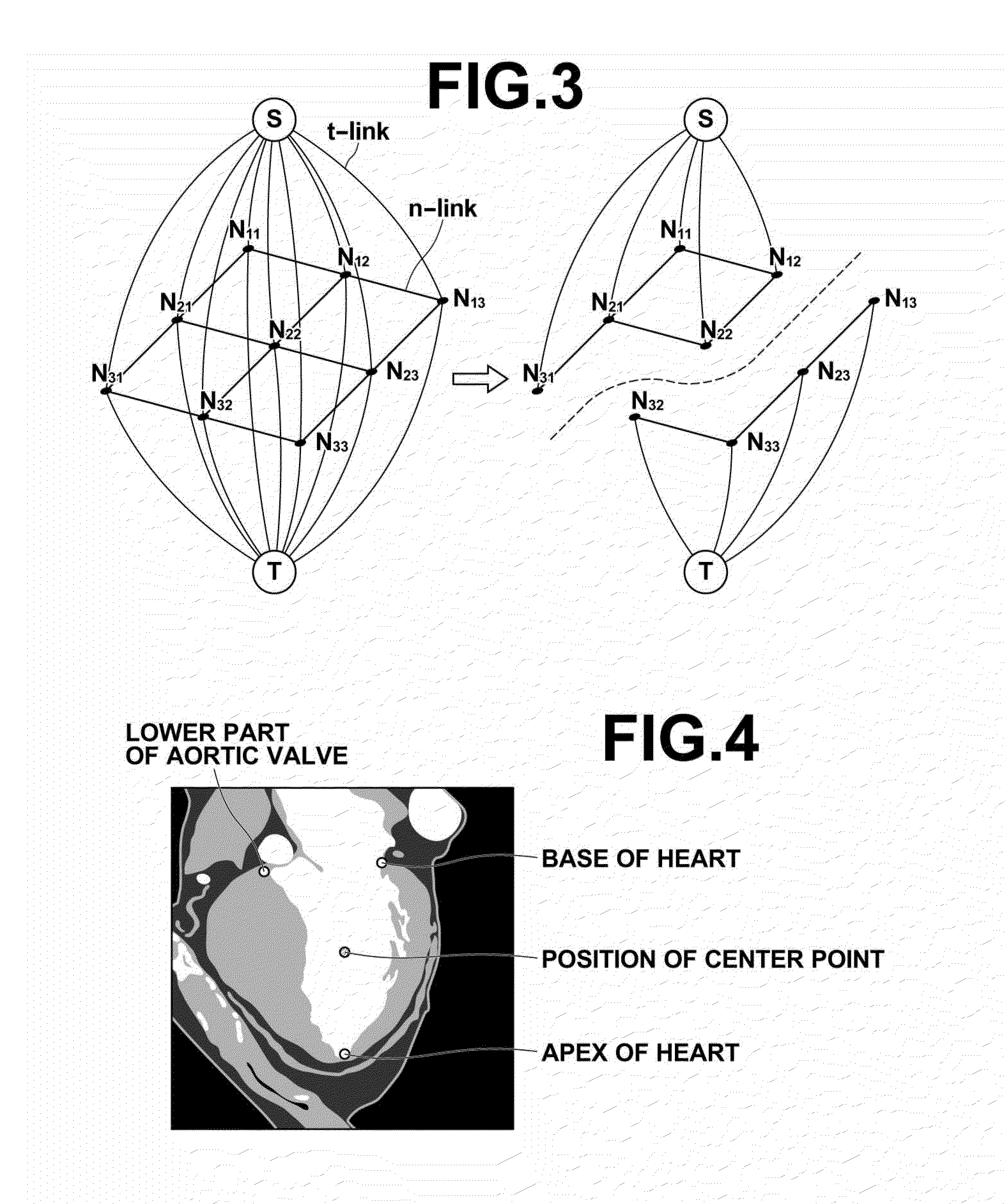 Medical image processing device, method and program