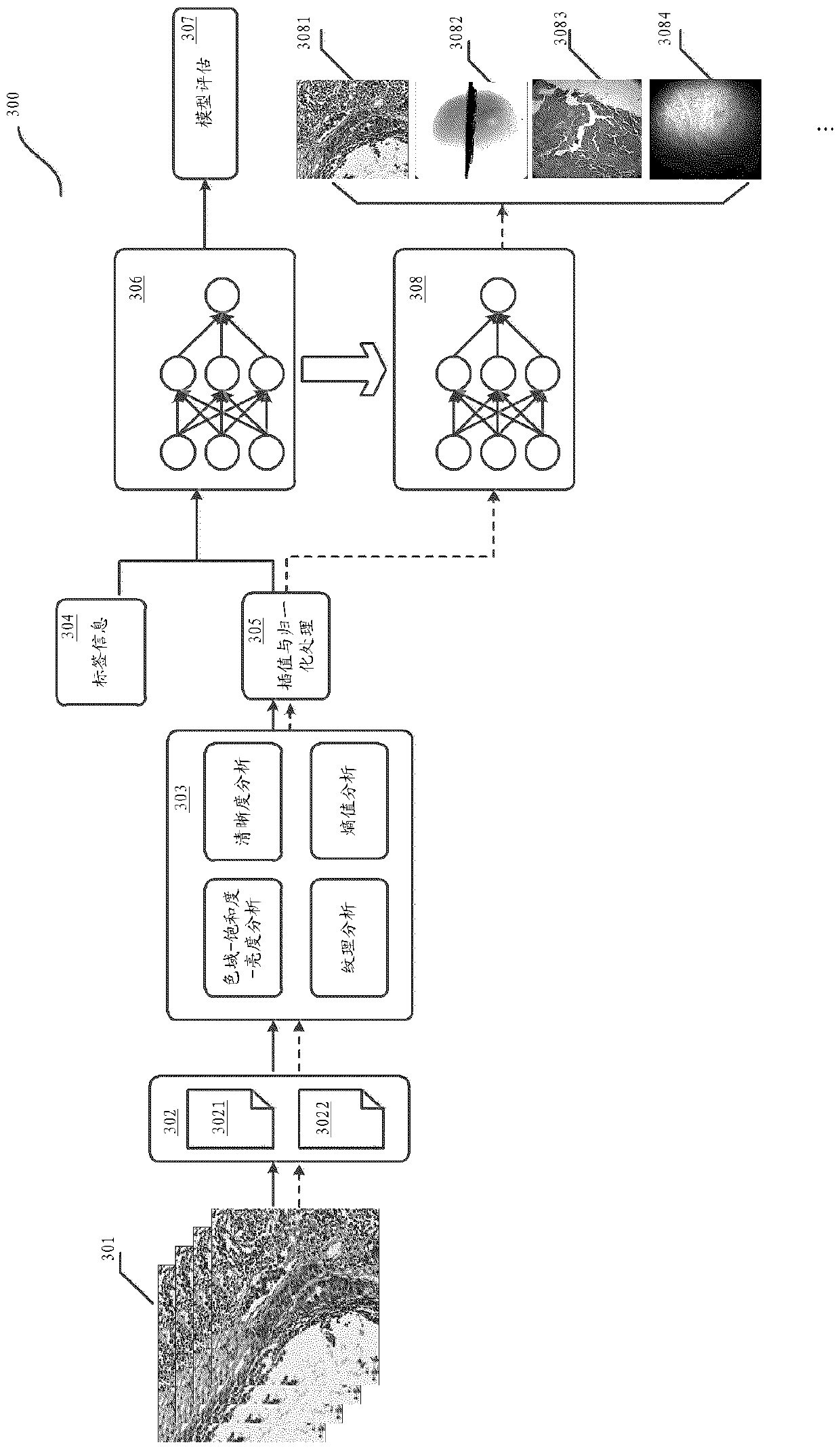 Medical image classification method, model training method and server