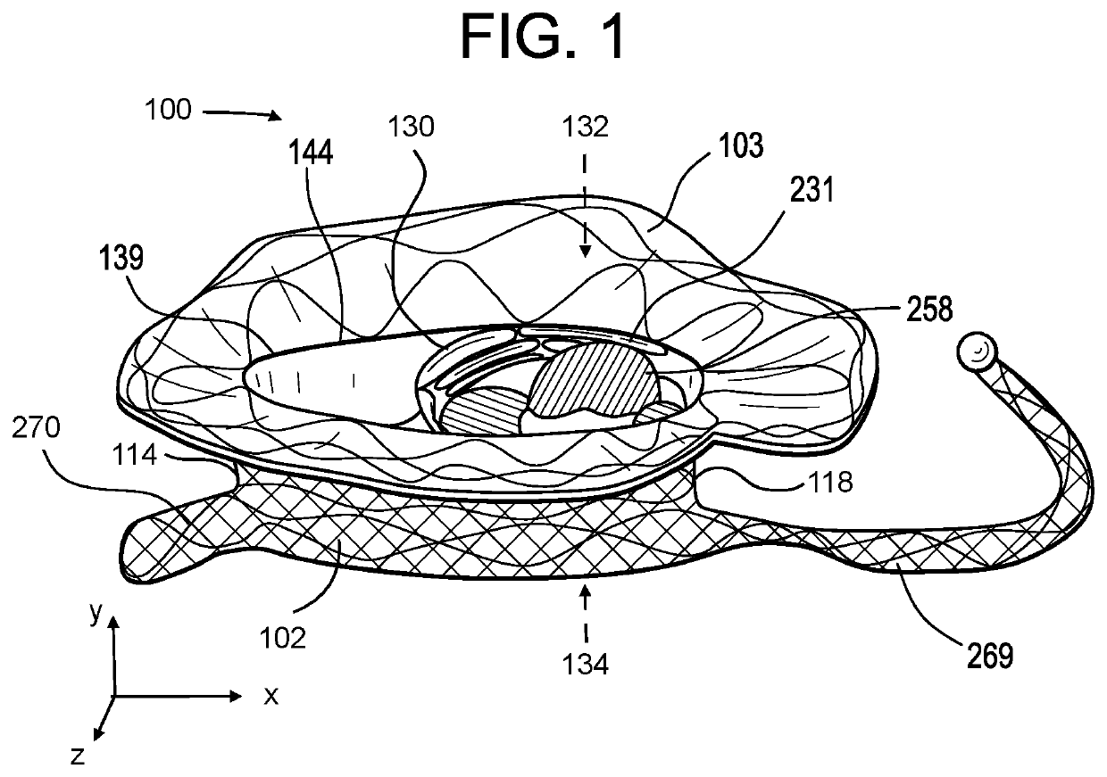 Proximal, distal, and anterior anchoring tabs for side-delivered transcatheter mitral valve prosthesis