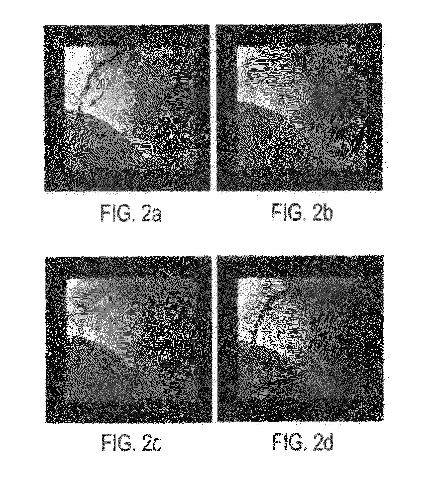 Method and System for Image Based Device Tracking for Co-registration of Angiography and Intravascular Ultrasound Images