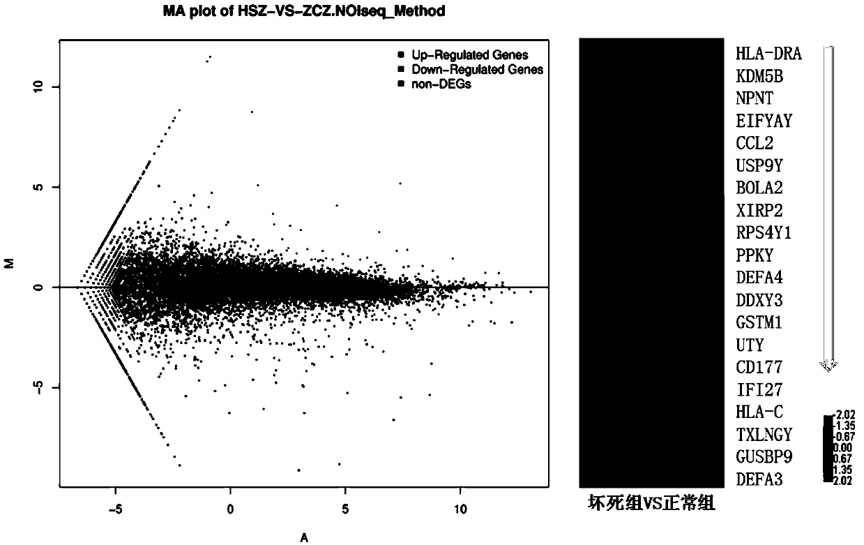 Detection marker of steroid-induced osteonecrosis of femoral head necrosis and application thereof