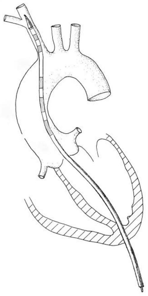 The anchoring of an anchoring of an anatomical anchoring and the anchoring of the anchor and the conveyor system