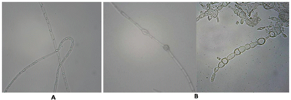 Strain of antagonistic poplar colletotrichumgloeosporioides and application thereof