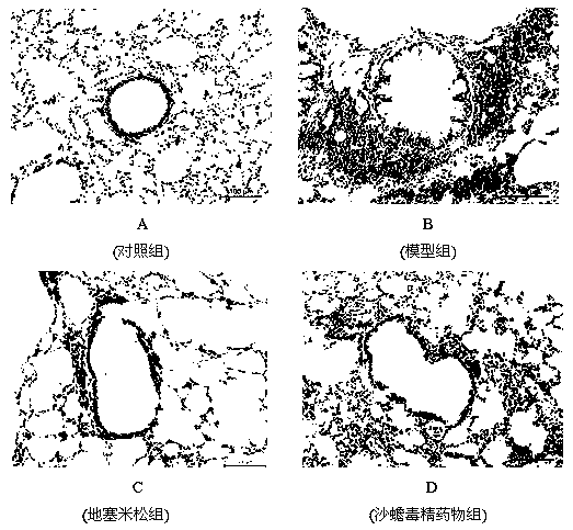 Application of sandbufalin in prevention/treatment of asthma drugs