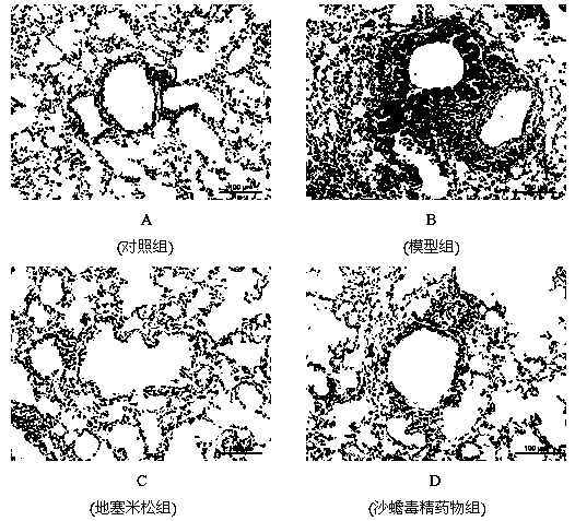 Application of sandbufalin in prevention/treatment of asthma drugs