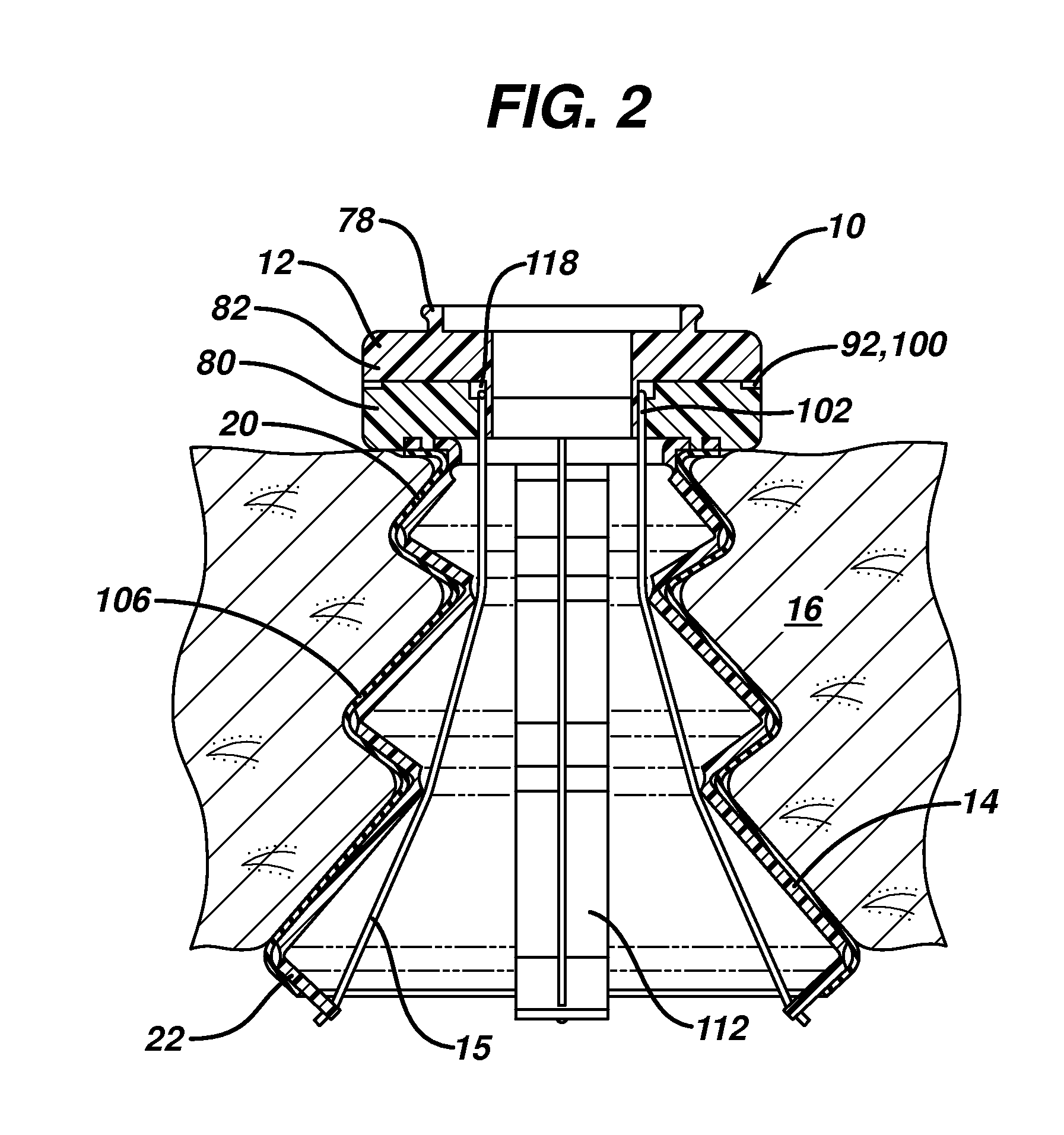 Inverted conical expandable retractor with coil spring