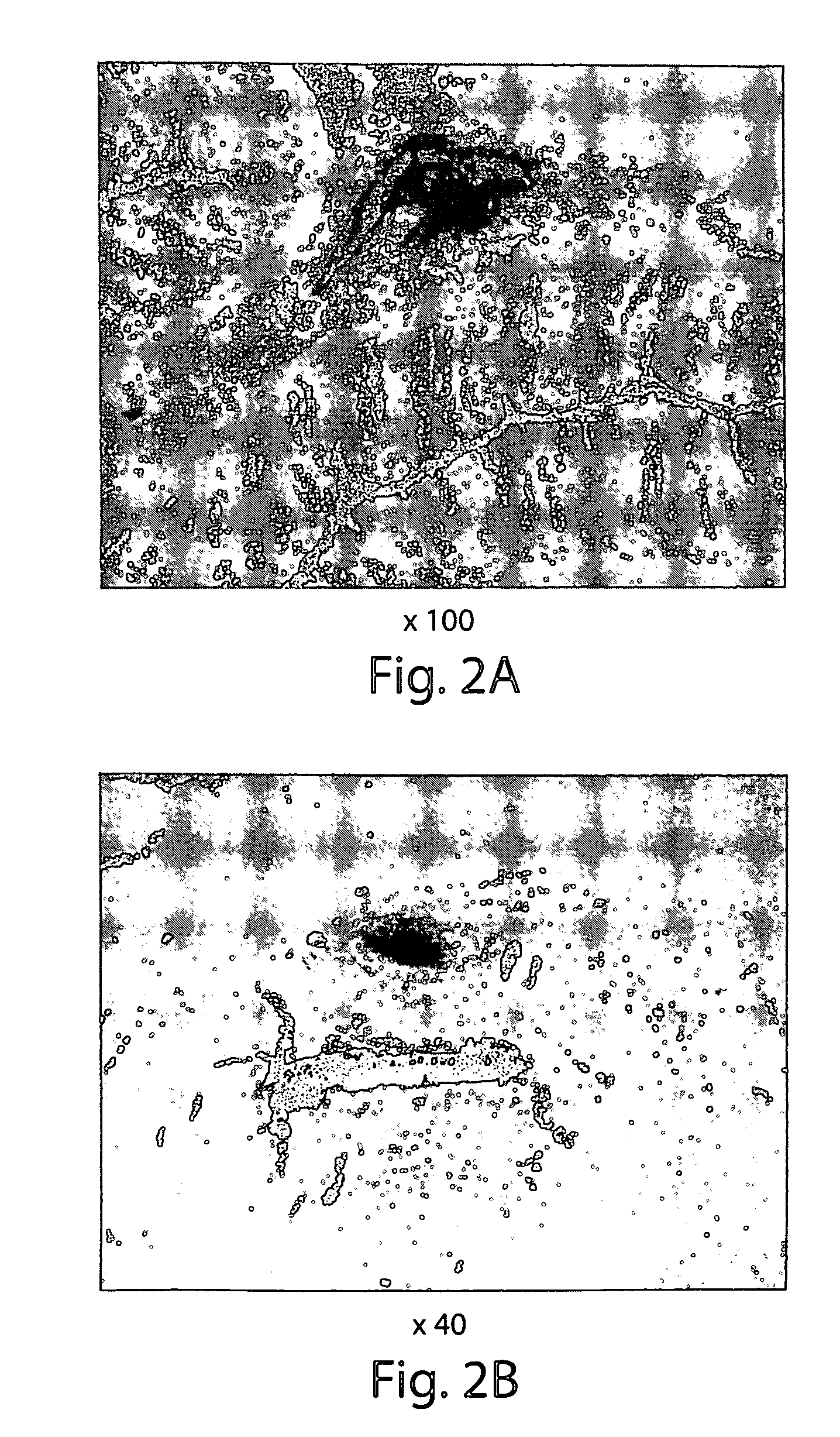 Muscle derived cells for the treatment of cardiac pathologies and methods of making and using the same