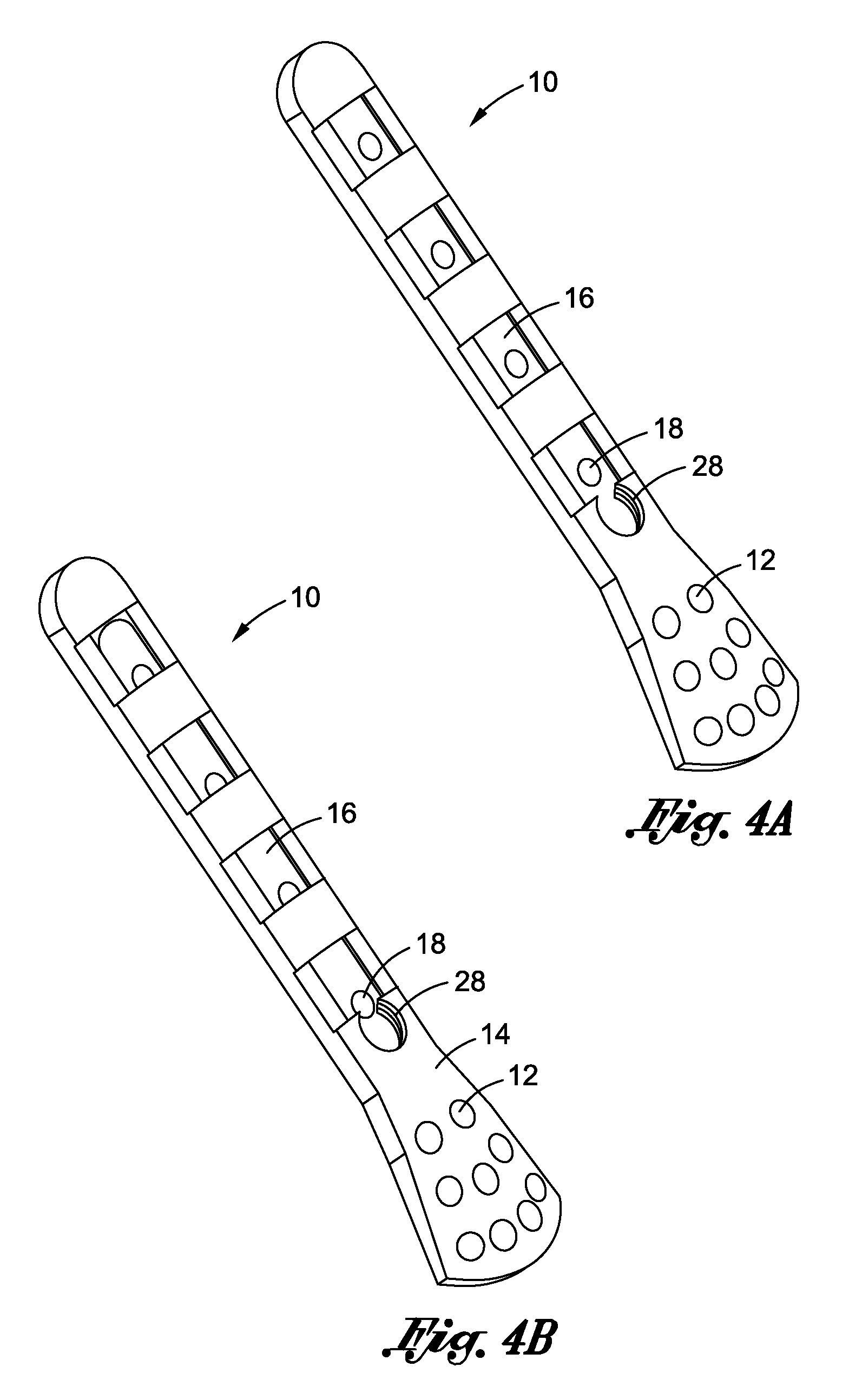 Dynamization of fixed screw fracture plates