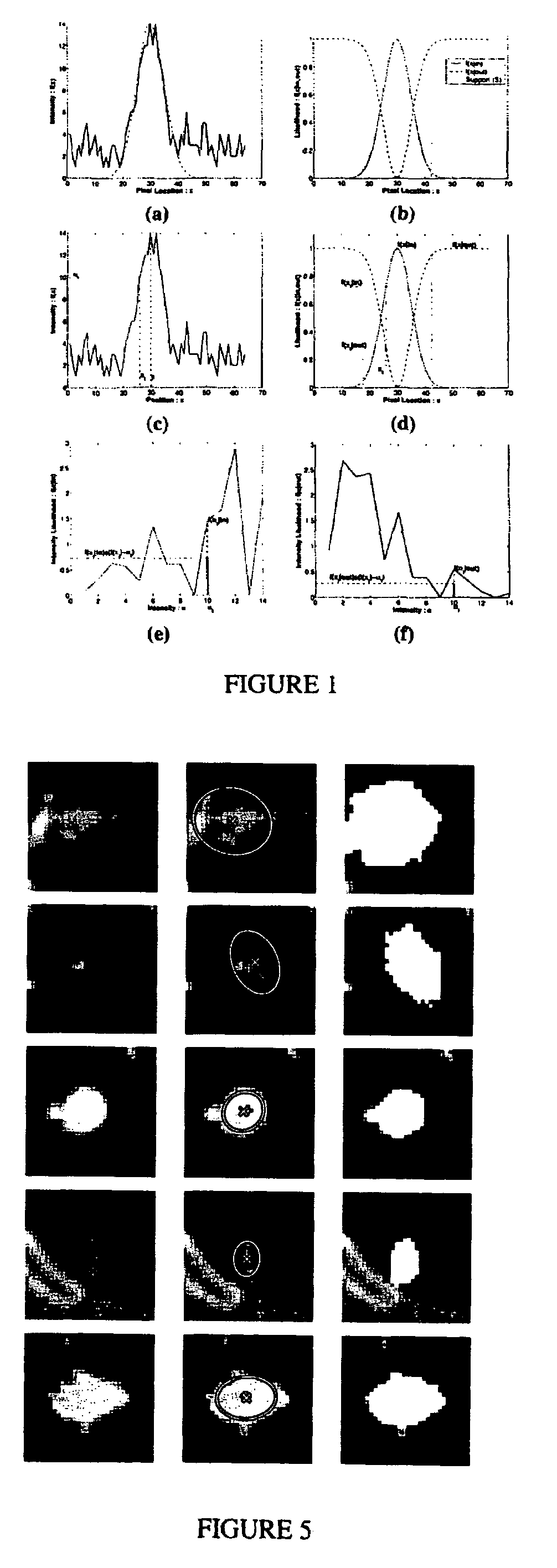 System and method for volumetric tumor segmentation using joint space-intensity likelihood ratio test