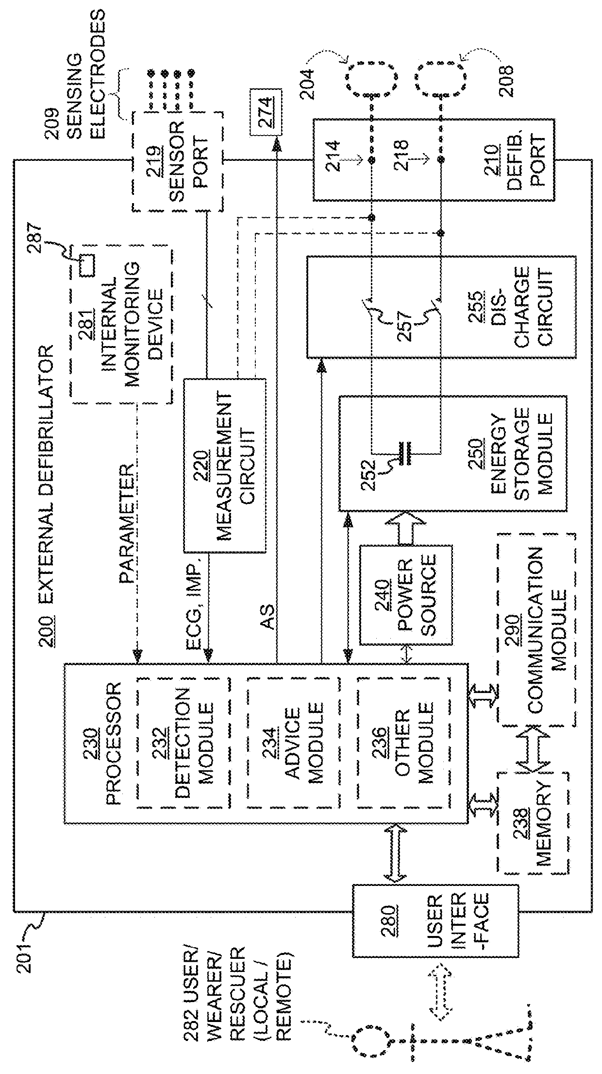 Wearable cardioverter defibrillator (WCD) system evaluating its ECG signals for noise according to tall peak counts