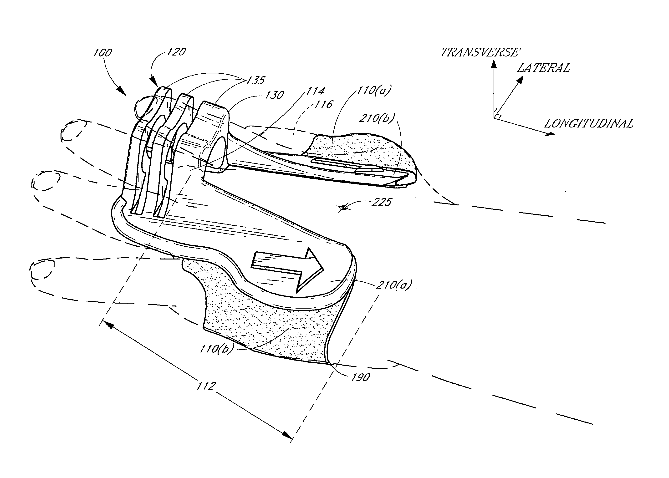 Anchoring system for use with neonates