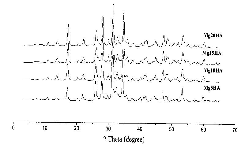 Method for preparing nano magnesium whitlockite powder