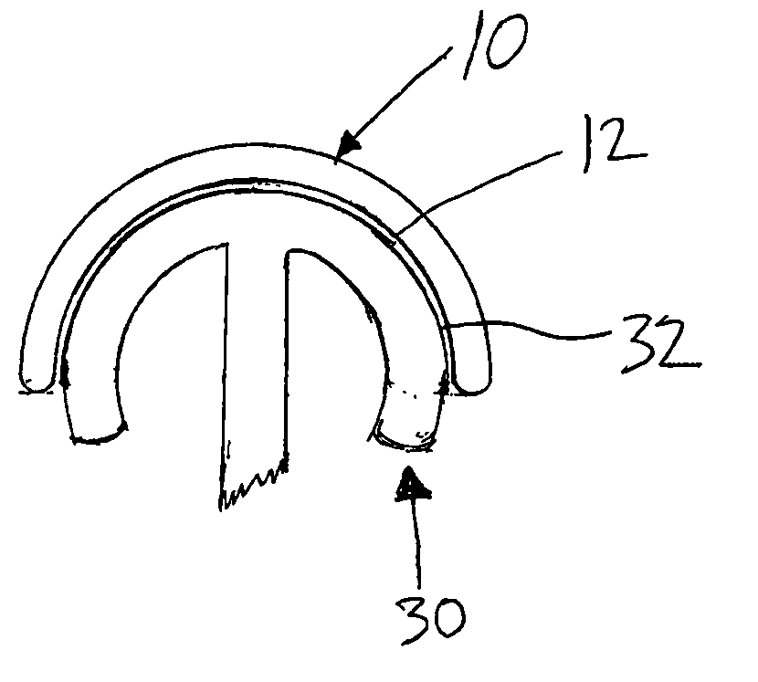 Metallic bearings for joint replacement