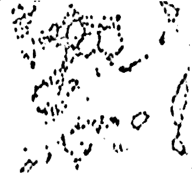 Biological demanganization deferrization functional bacterium