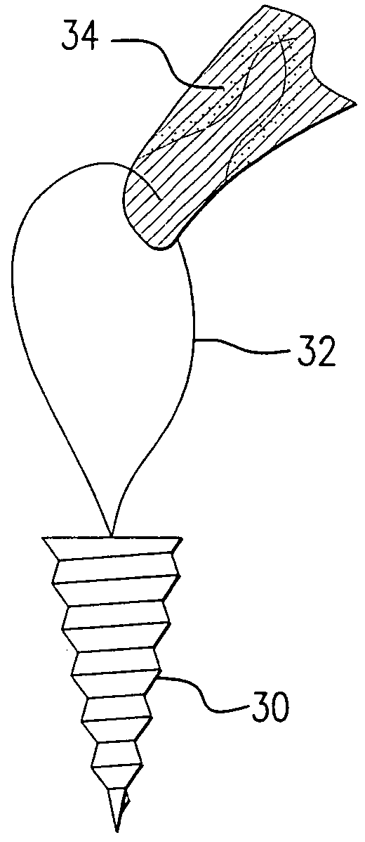 Method and device for securing sutures to bones