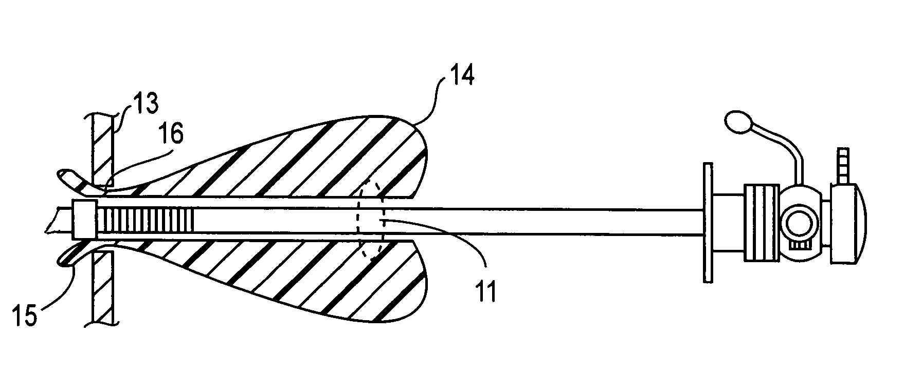 Method and system for minimizing leakage of a distending medium during endoscopic procedures