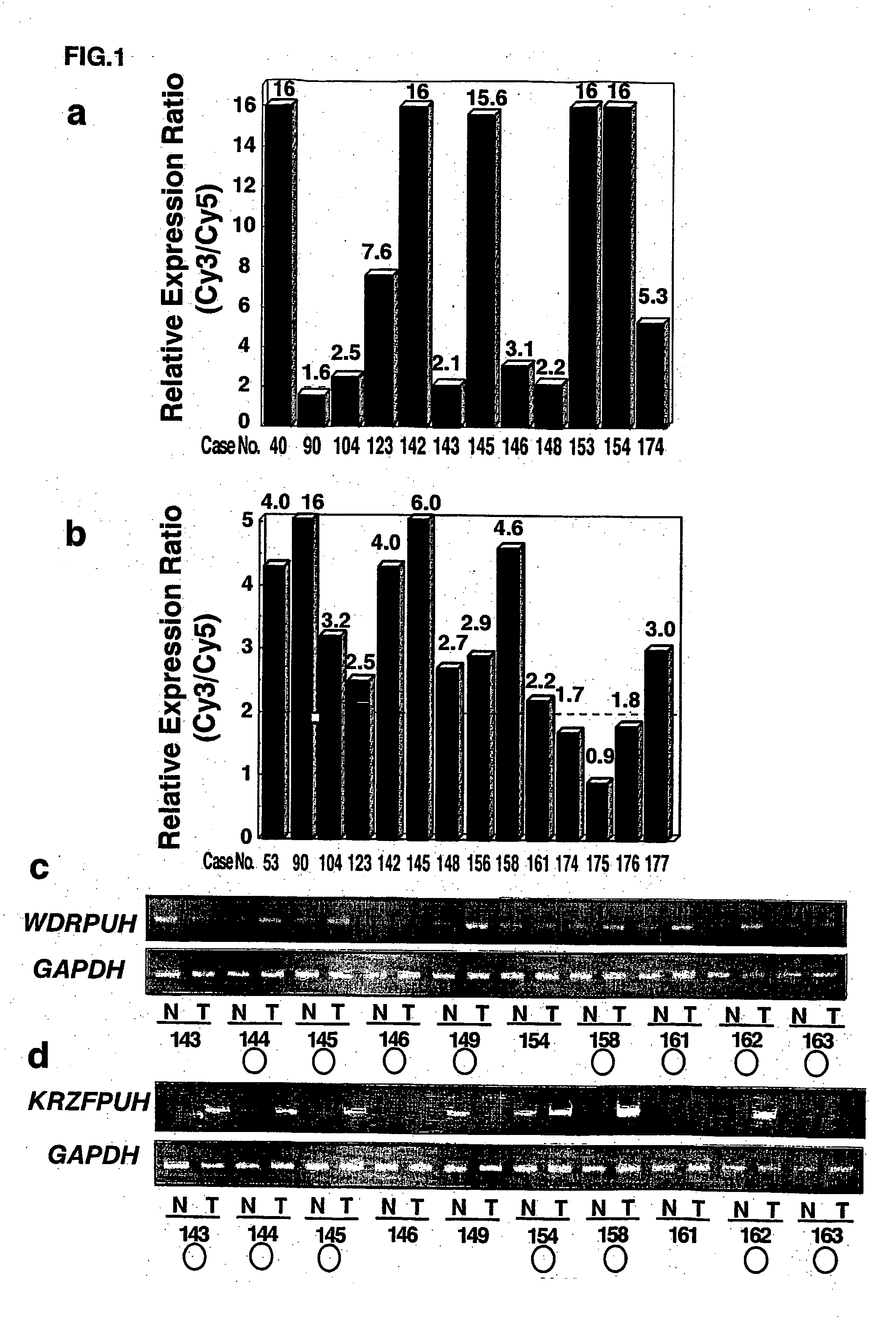 Genes and polypeptides relating to hepatocellular or colorectal carcinoma