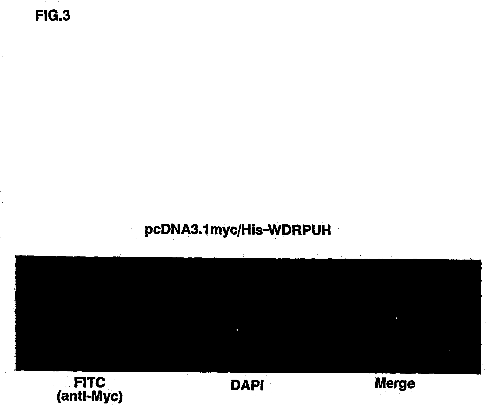 Genes and polypeptides relating to hepatocellular or colorectal carcinoma