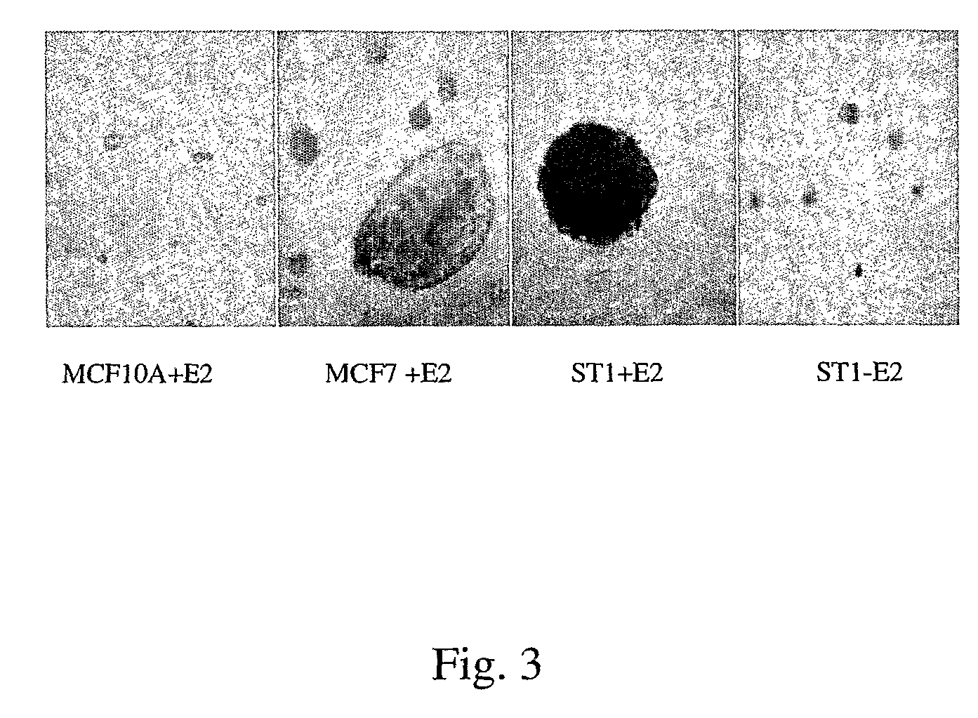 Estrogen Receptors and Methods of Use