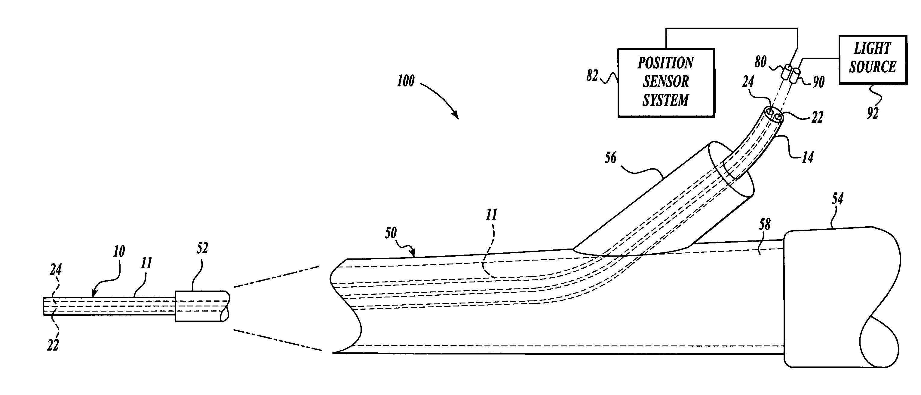 Vision catheter having electromechanical navigation