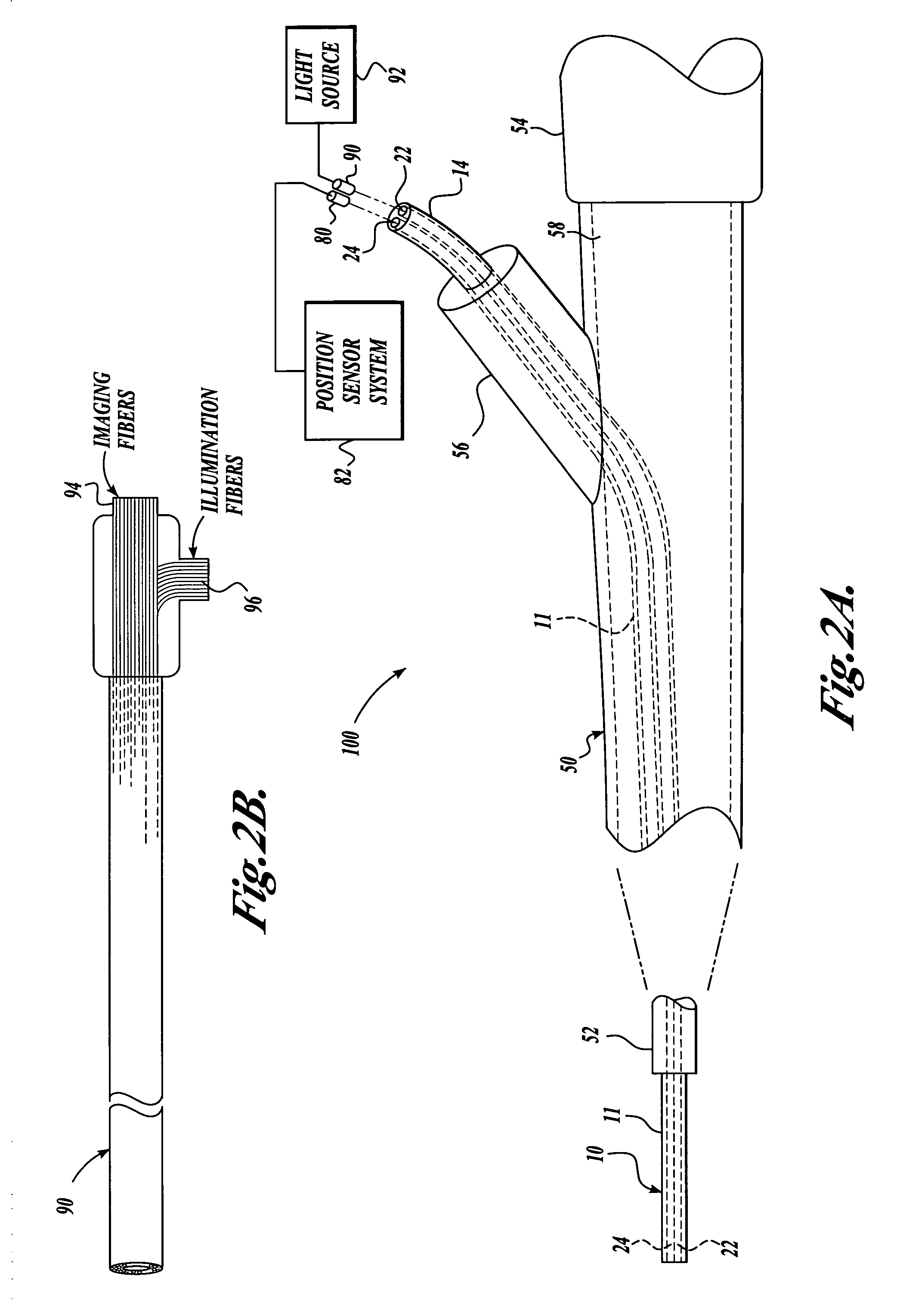 Vision catheter having electromechanical navigation