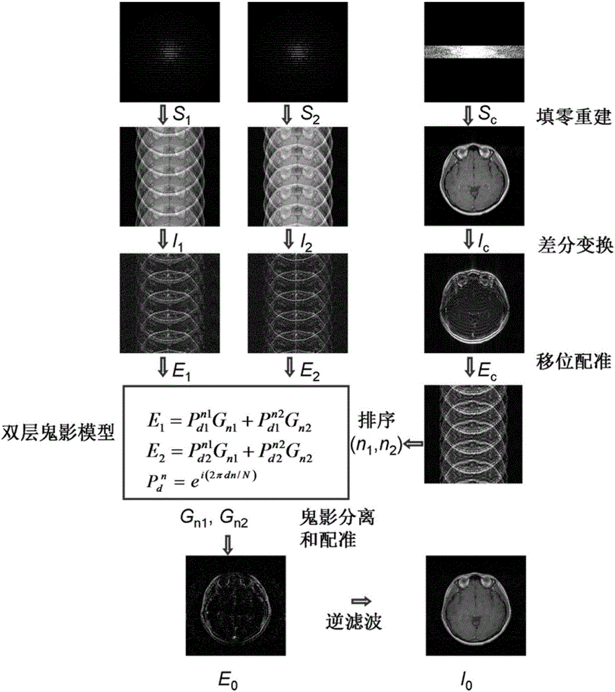 SPEED magnetic resonance imaging method based on k space center ghost positioning