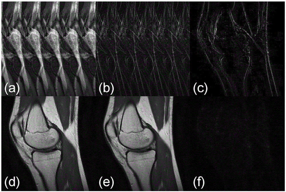 SPEED magnetic resonance imaging method based on k space center ghost positioning