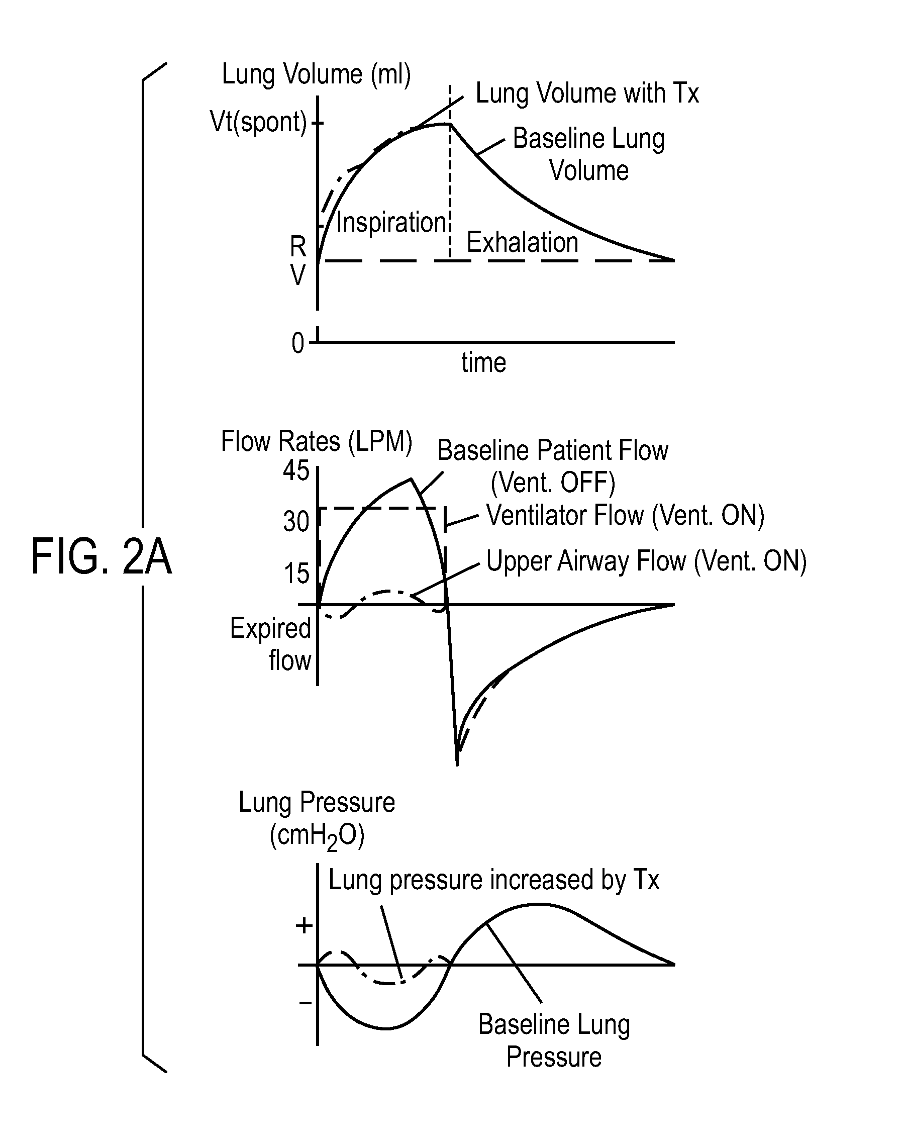 Ventilator with biofeedback monitoring and control for improving patient activity and health