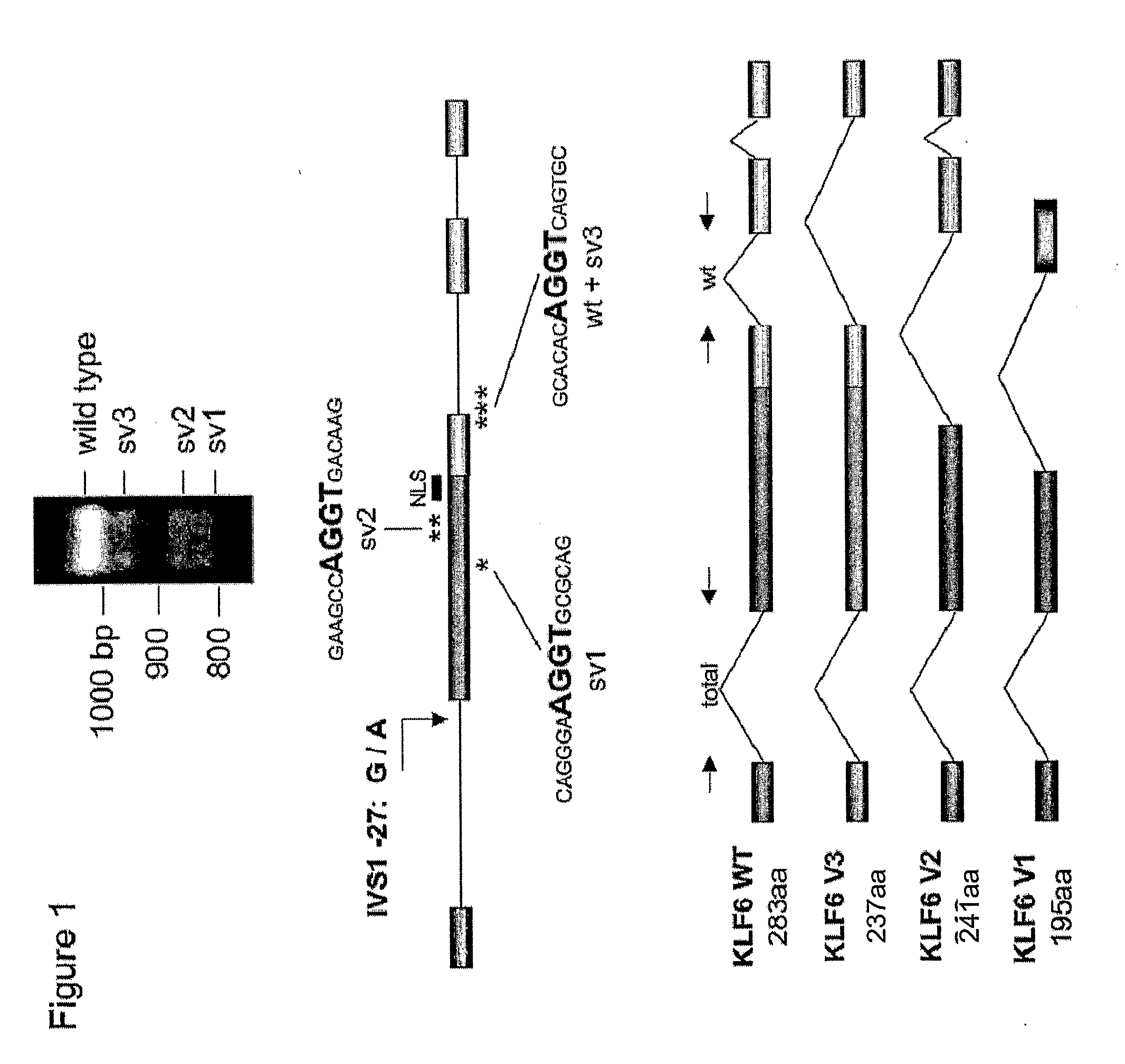 Klf6 alternative splice forms and a germline klf6 DNA polymorphism associated with increased cancer risk