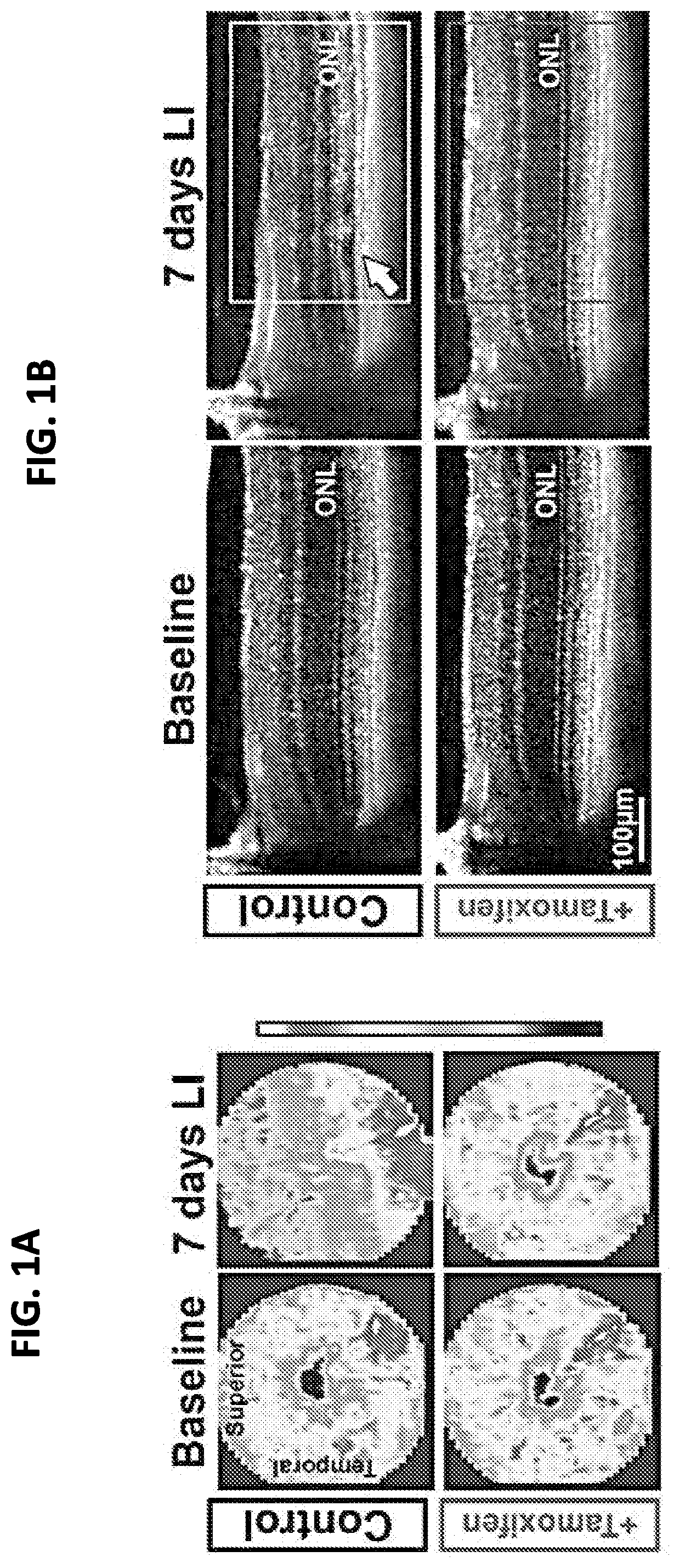 Selective estrogen-receptor modulators (SERMs) confer protection against photoreceptor degeneration