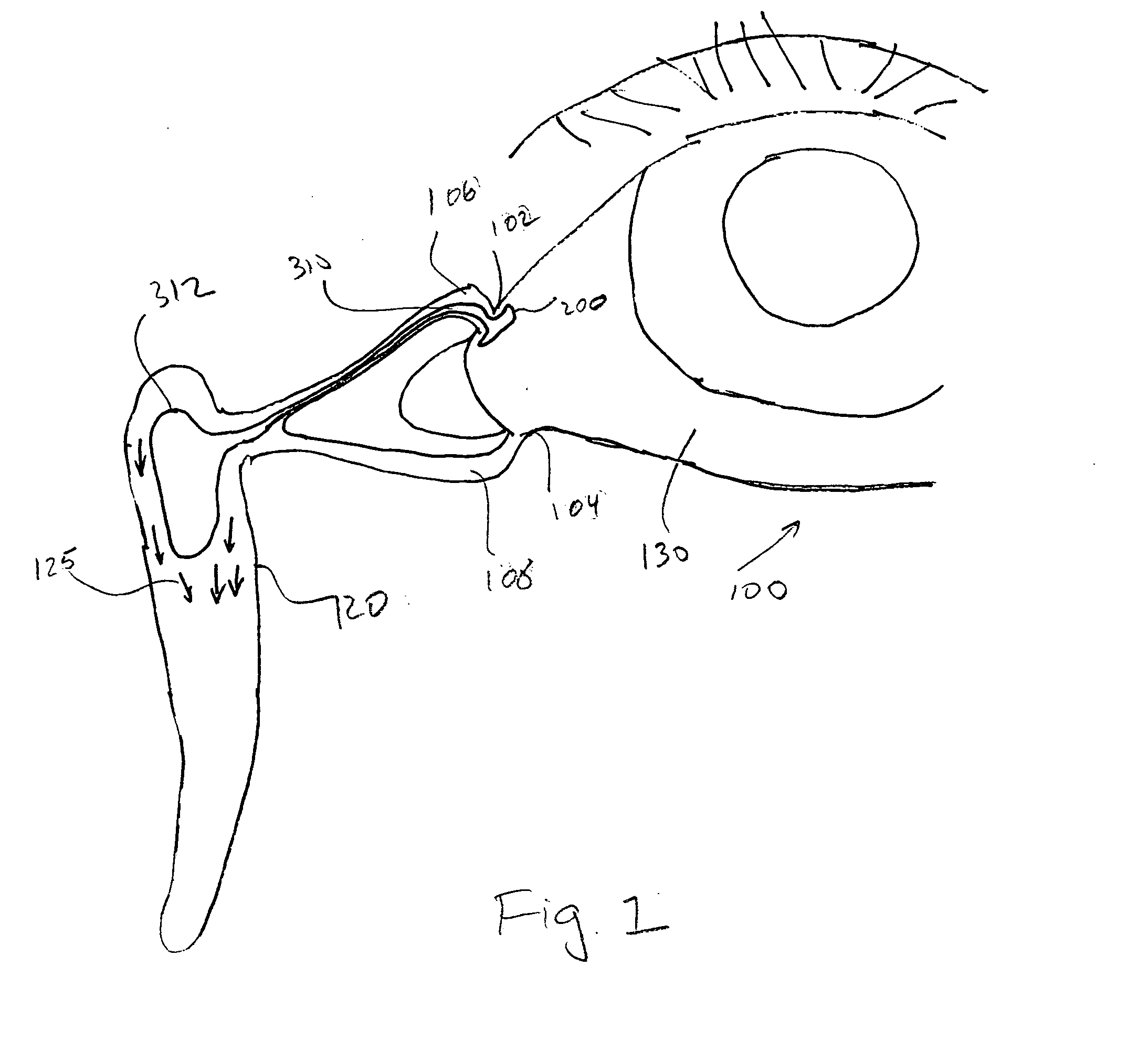 Ophthalmic insert