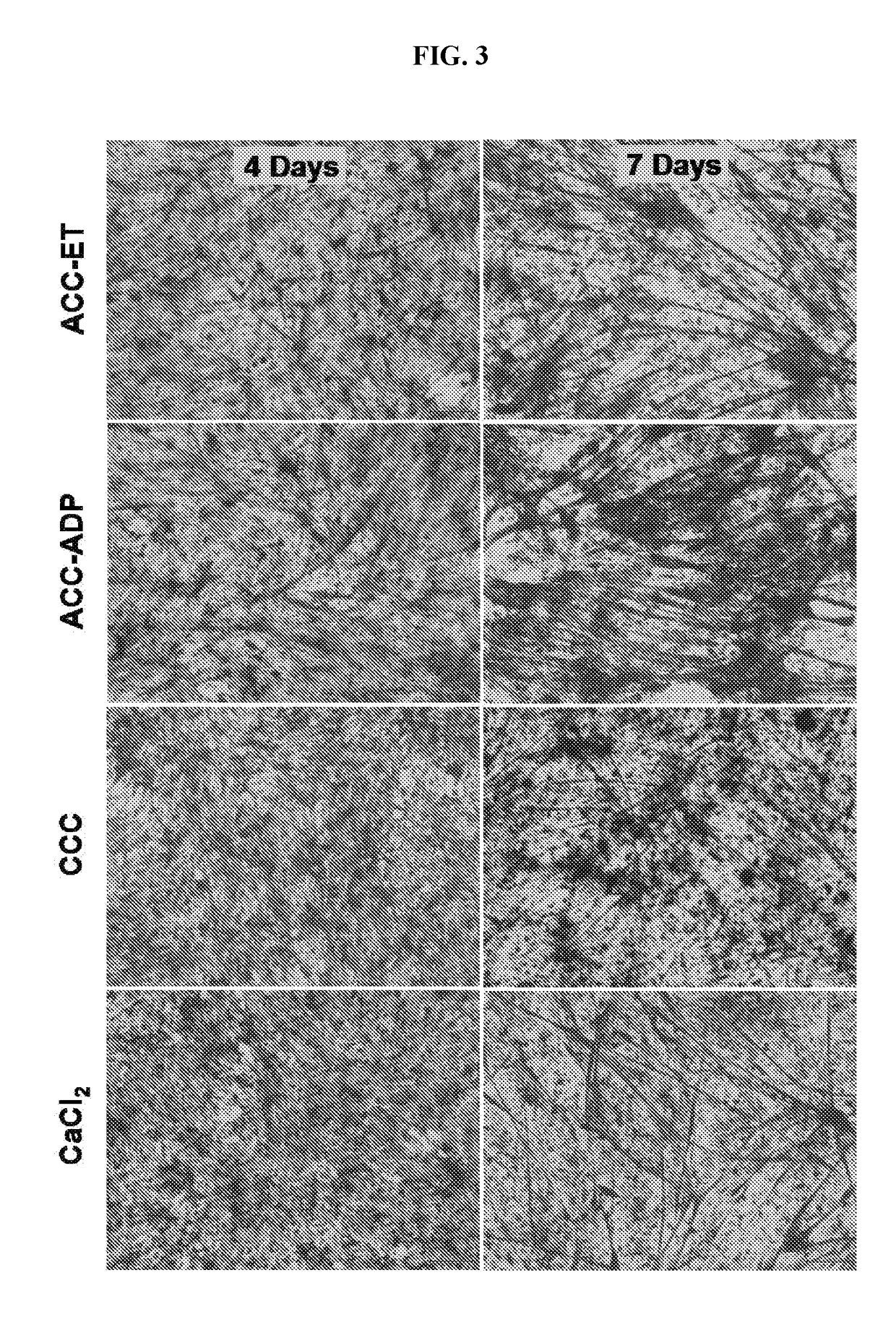 Stabilized amorphous calcium carbonate for treatment of neurological, muscular and infertility diseases or conditions