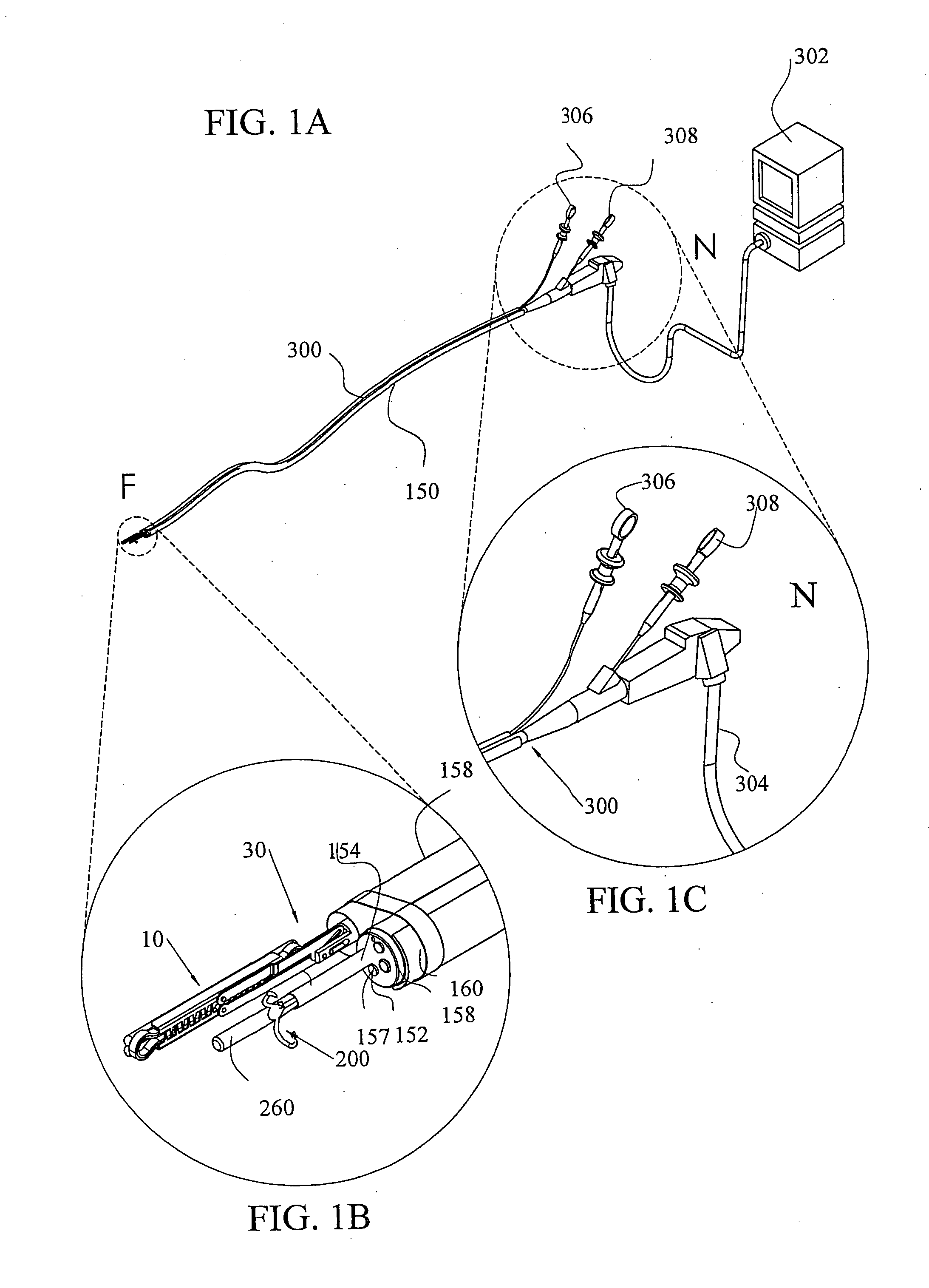 Tissue compression using surgical clips