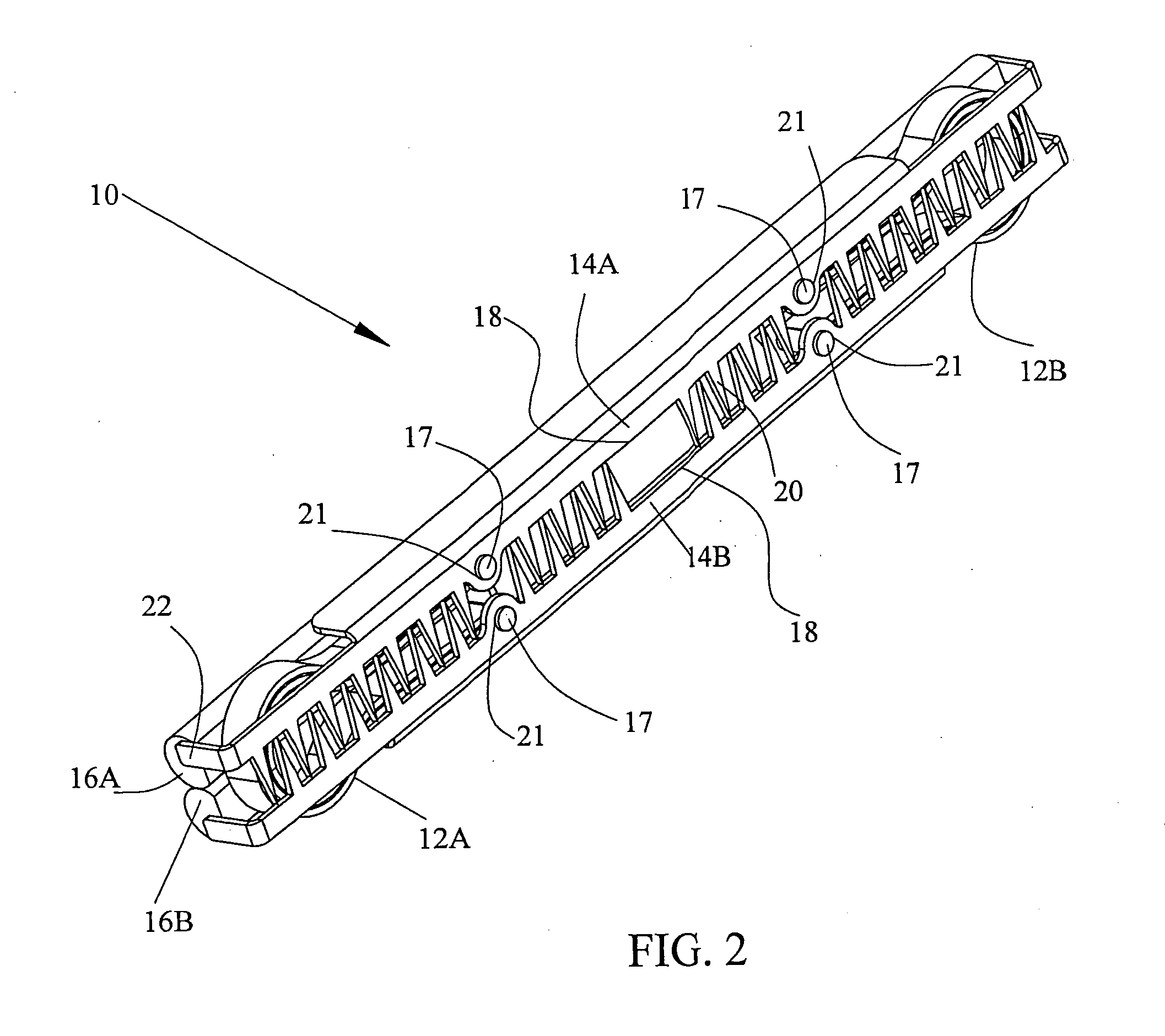 Tissue compression using surgical clips