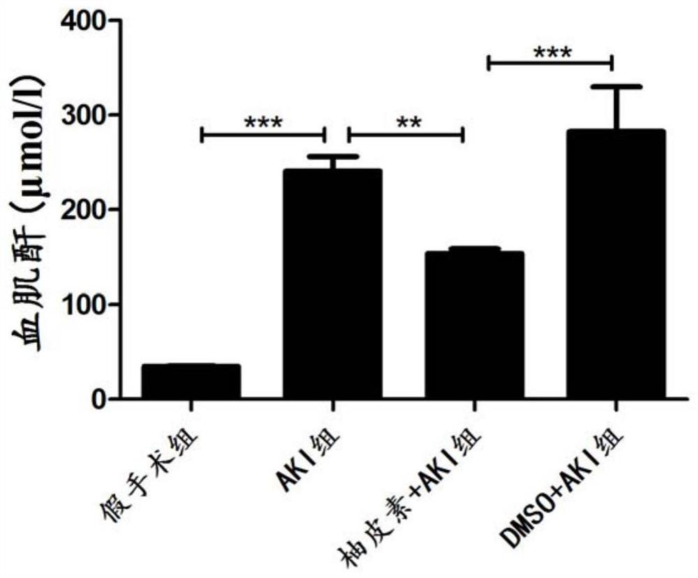 Application of naringenin in preparation/protection of renal ischemia reperfusion injury through relieving of renal inflammatory response