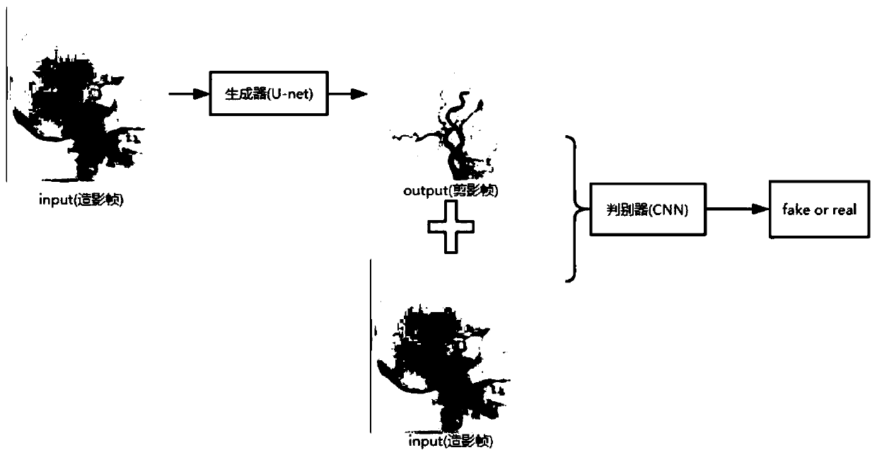 U-net based generation adversarial network DSA imaging method and device