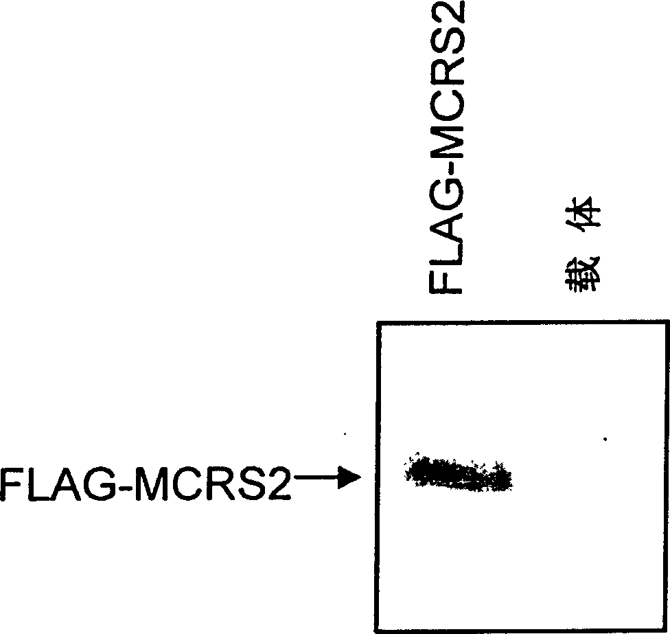 Human telomerase active inhibitor protein and use thereof