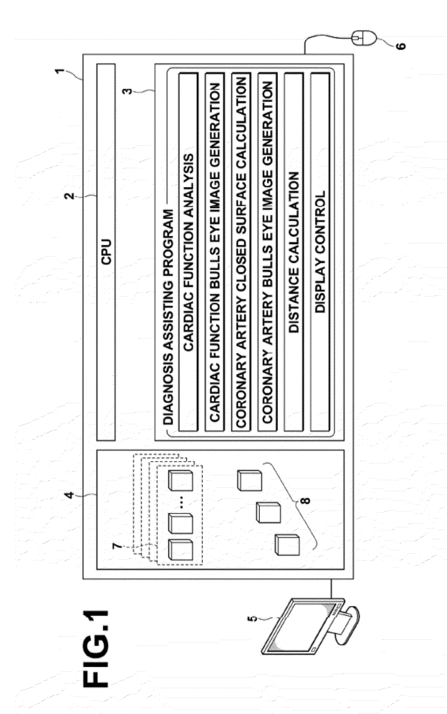 Diagnosis assisting apparatus, diagnosis assisting method, and storage medium having a diagnosis assisting program recorded therein