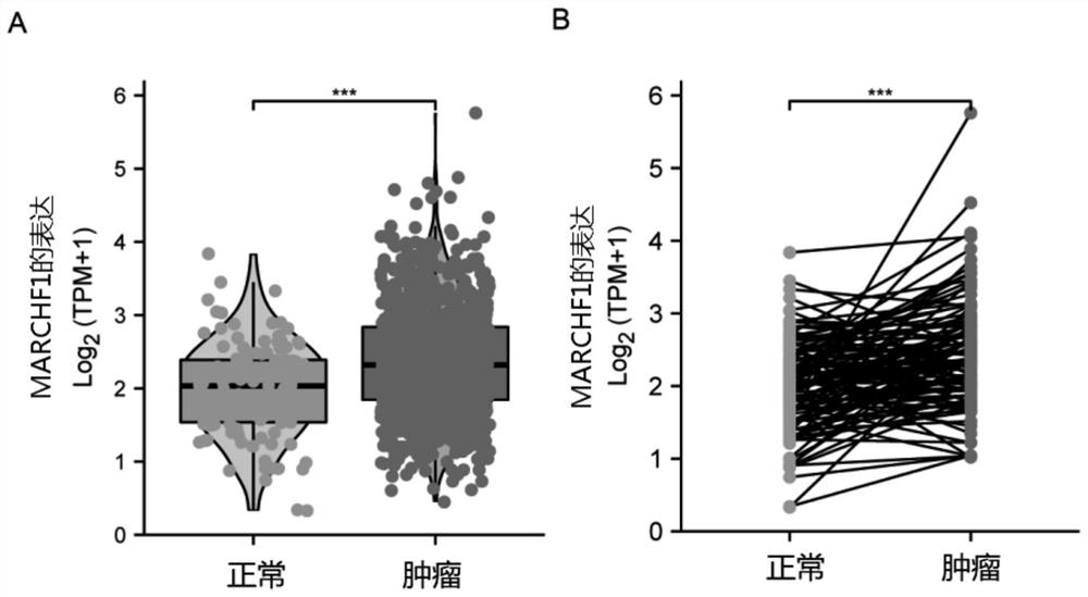 Detection kit for breast cancer assisted immunotherapy target gene MARCHF1 and application