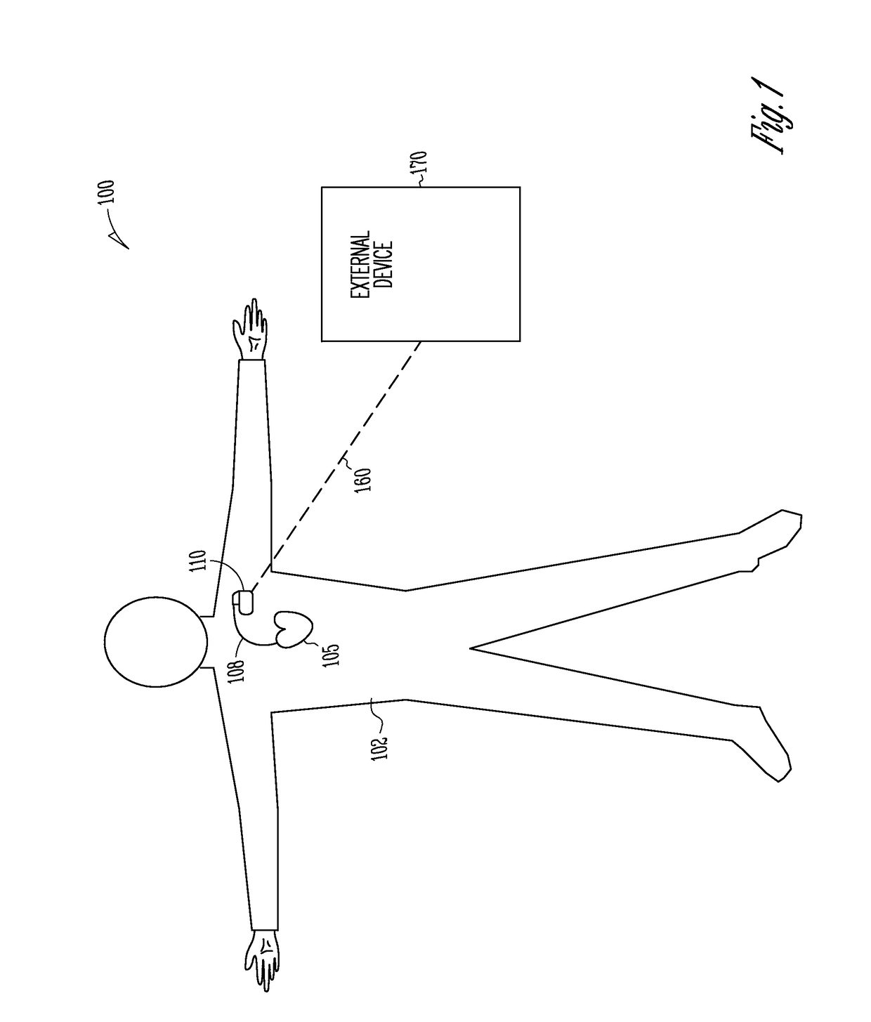 Intracardiac impedance and its applications