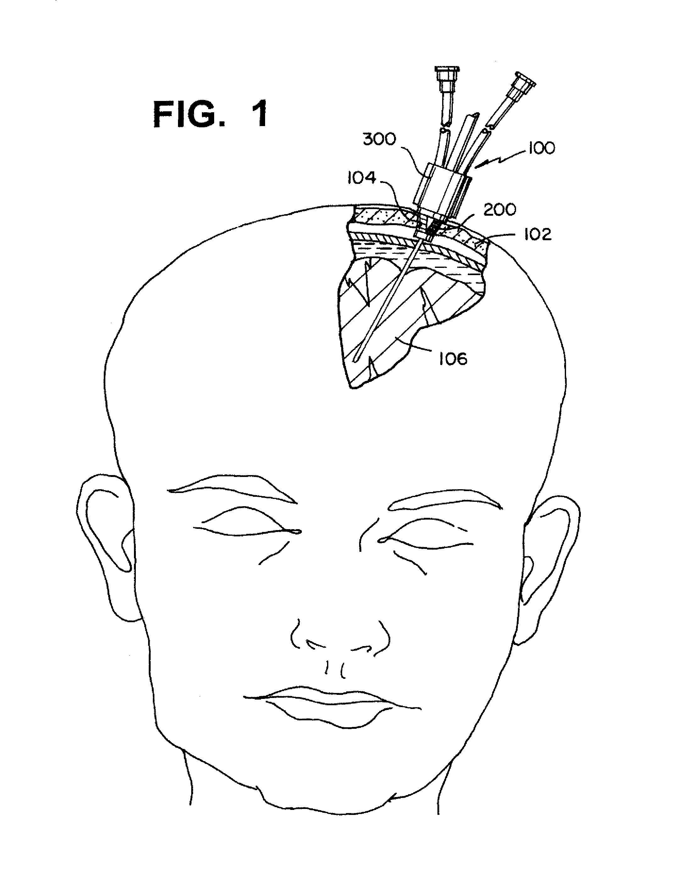 Multiple lumen sensor attachment