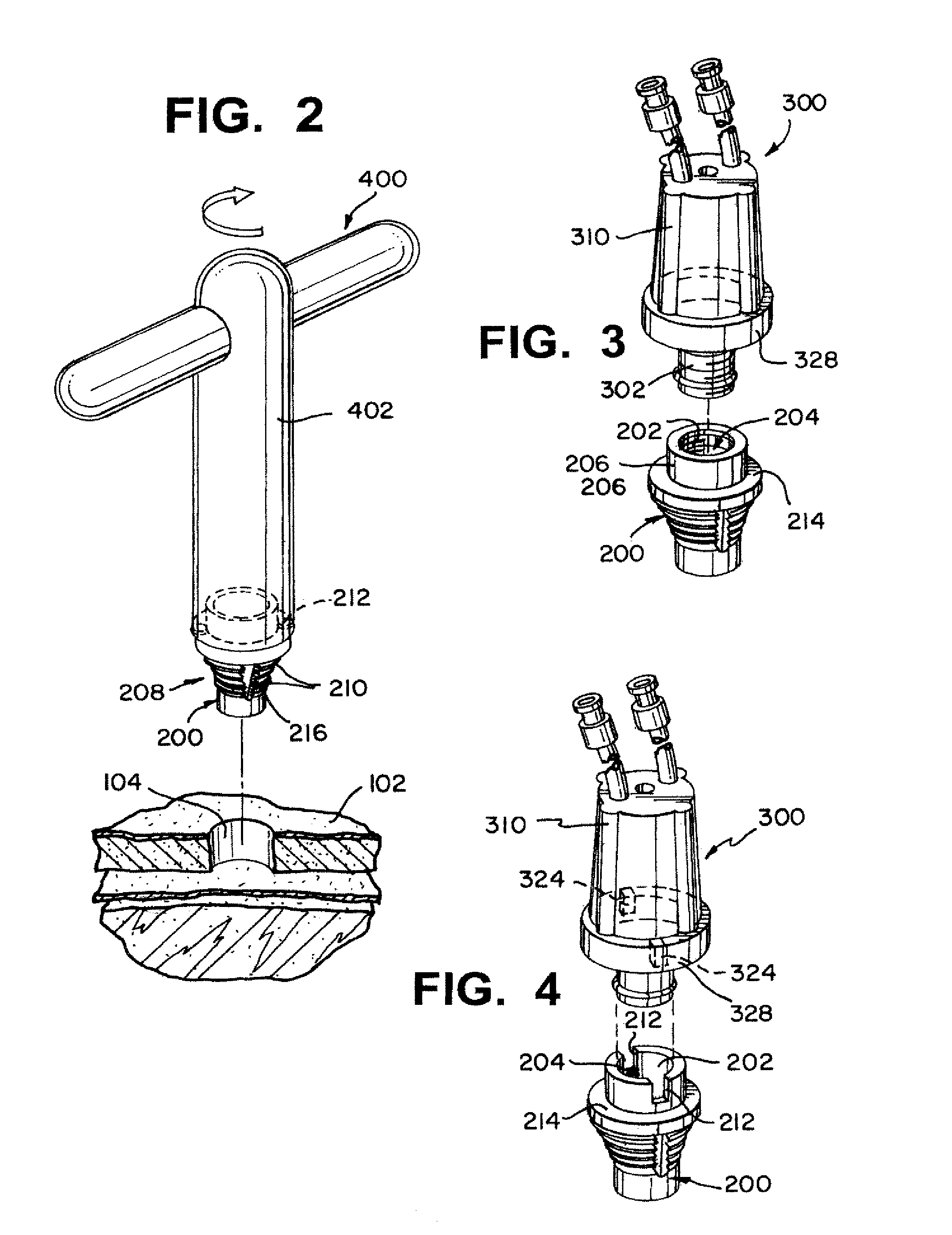 Multiple lumen sensor attachment