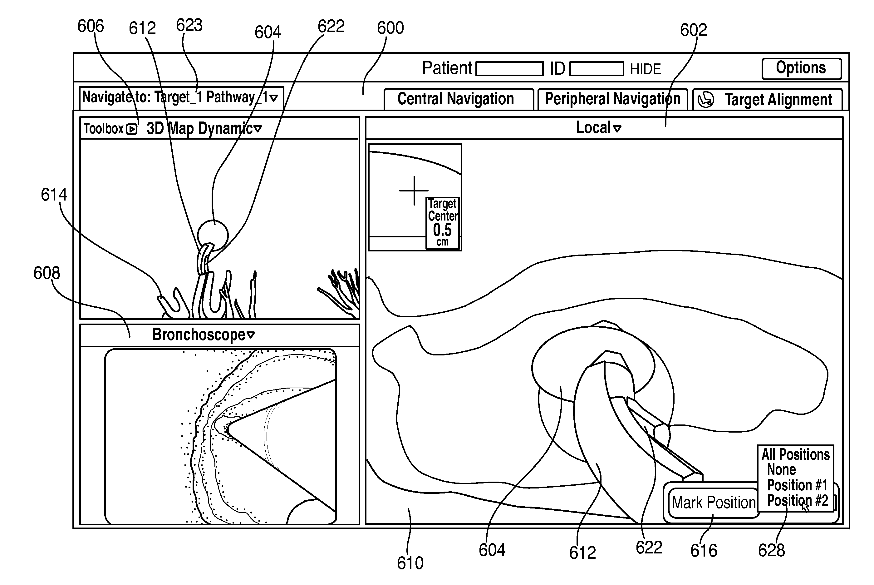 Methods for marking biopsy location