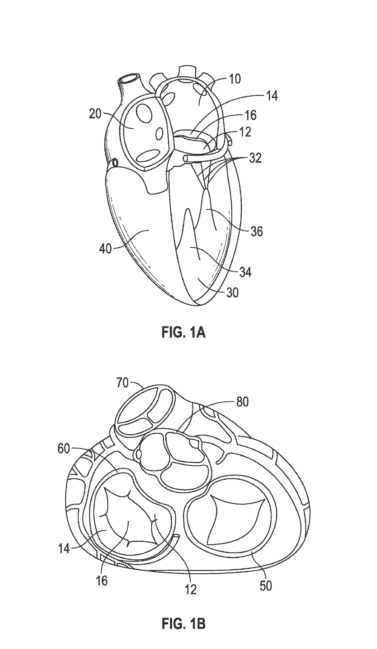 Systems and methods for anchoring an implant