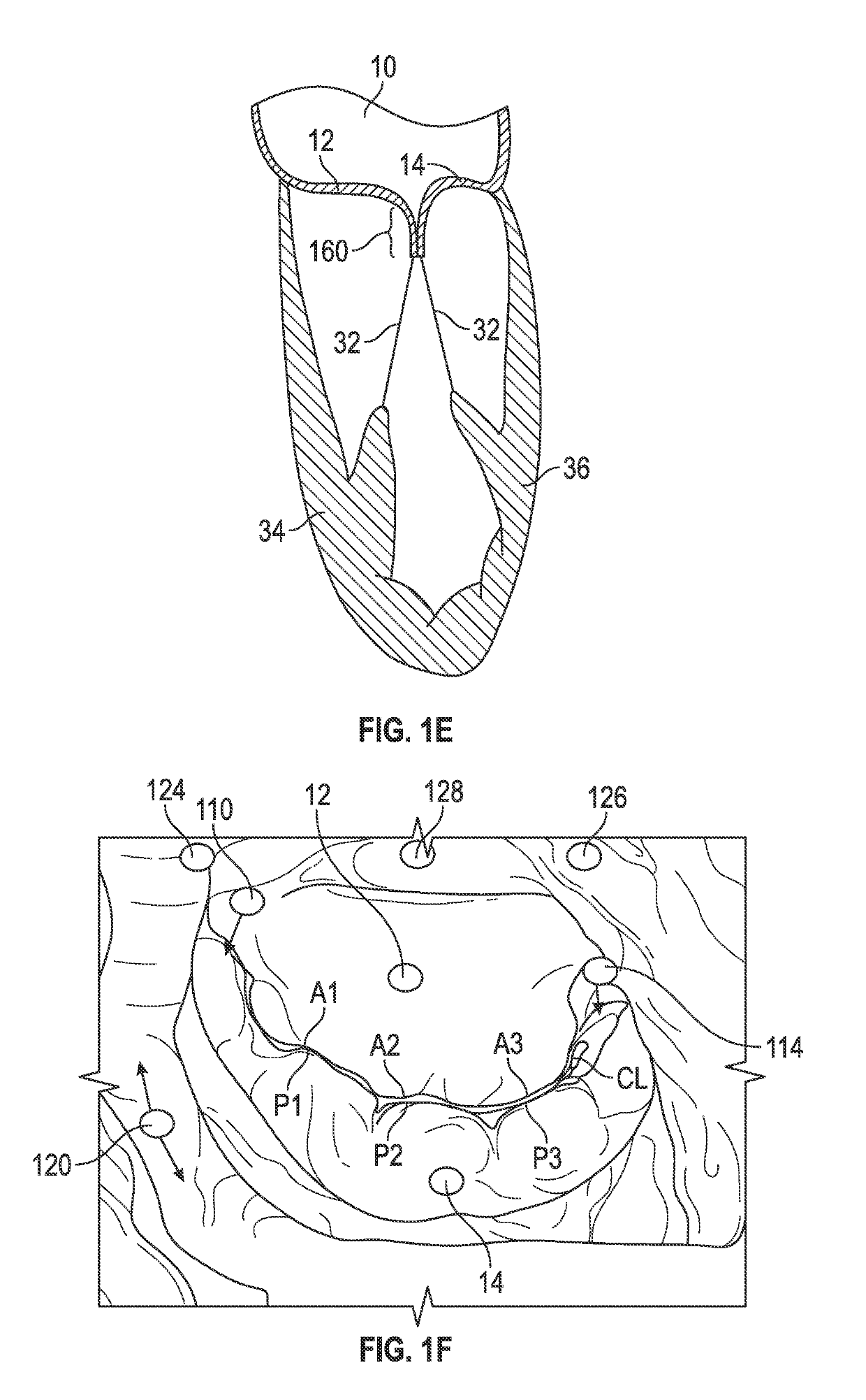 Systems and methods for anchoring an implant