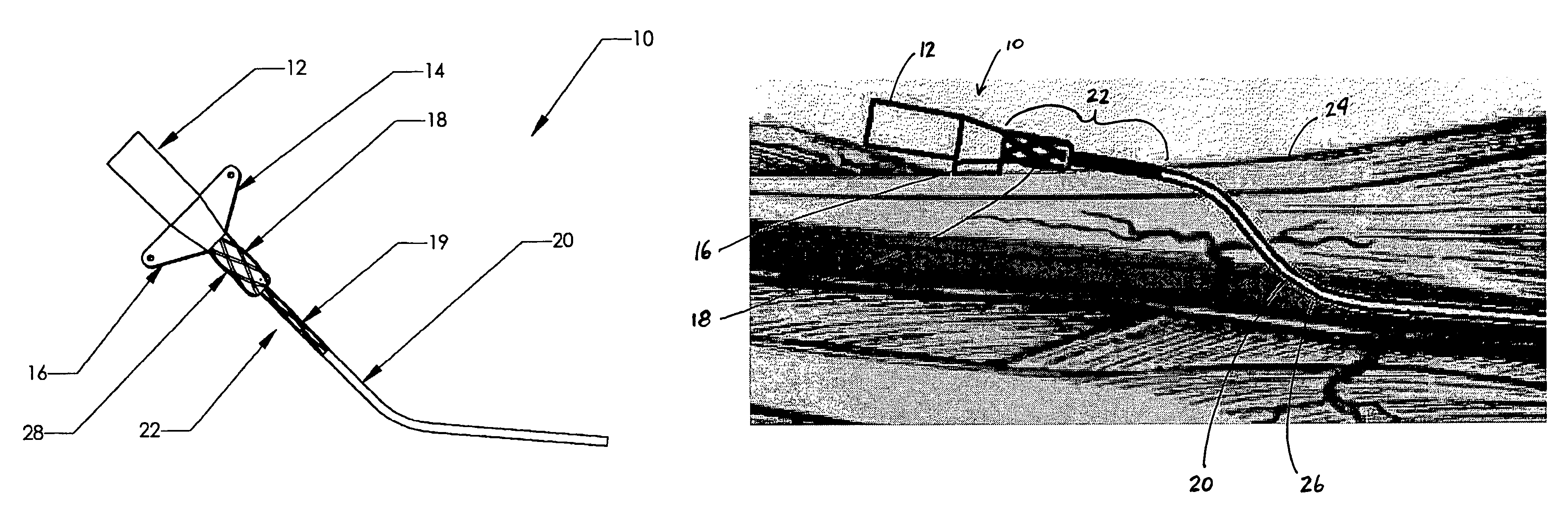 Catheter including textured interface