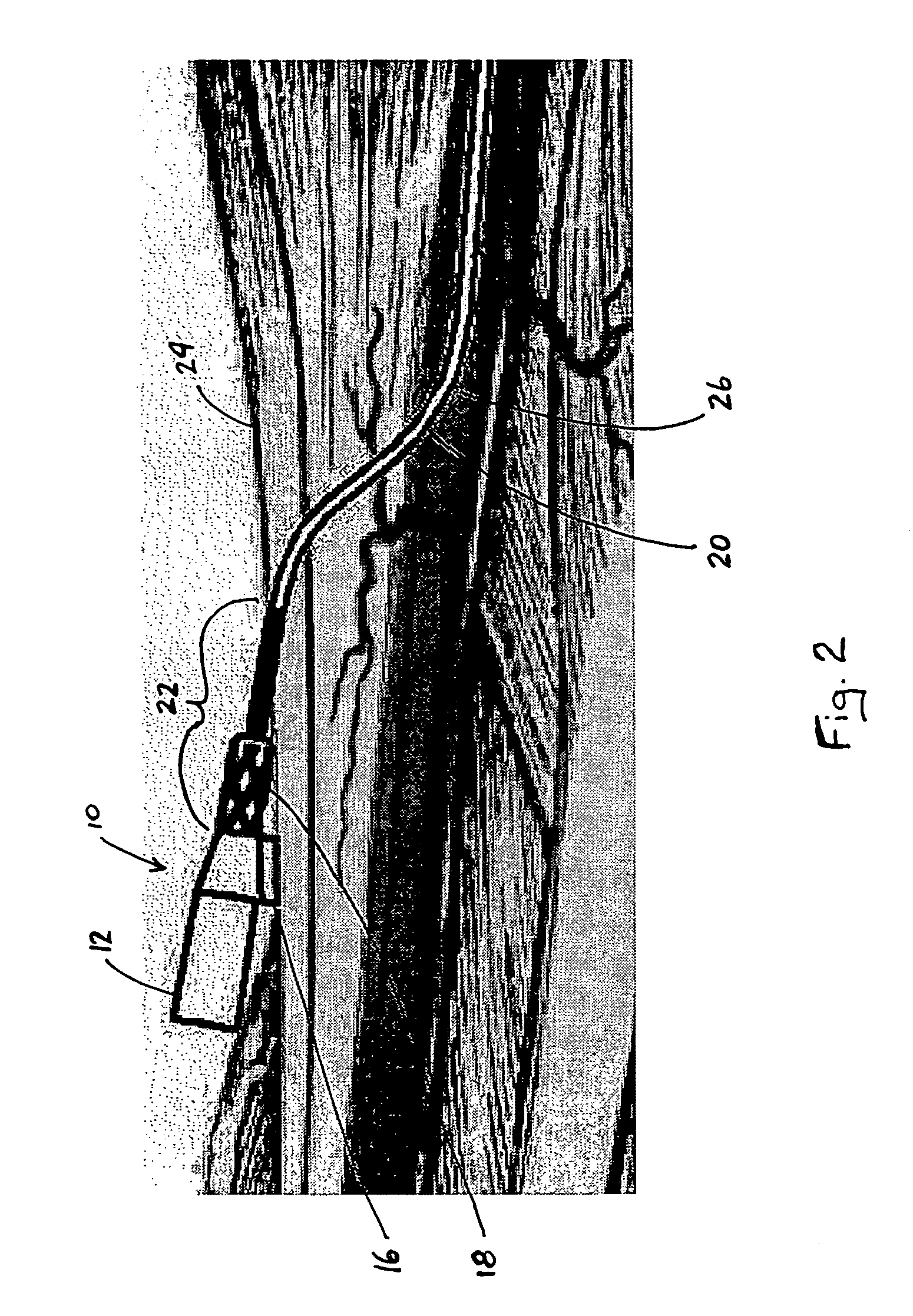 Catheter including textured interface