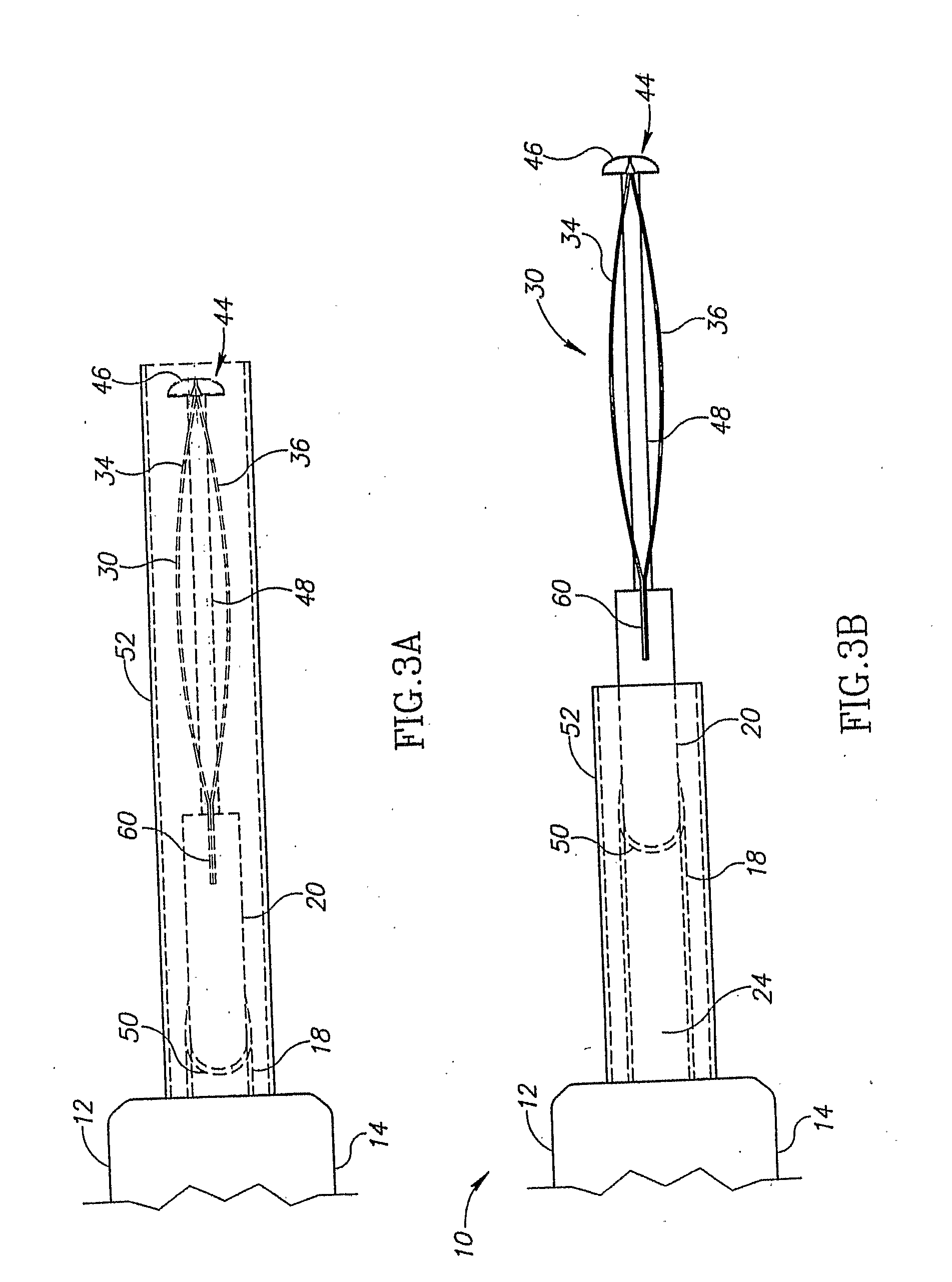 Thermal capsulotomy tool and system