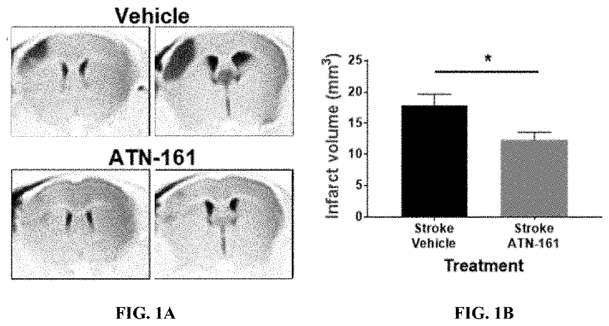 Inhibition of alpha5beta1 integrin with atn-161 as a novel therapy for vascular dementia